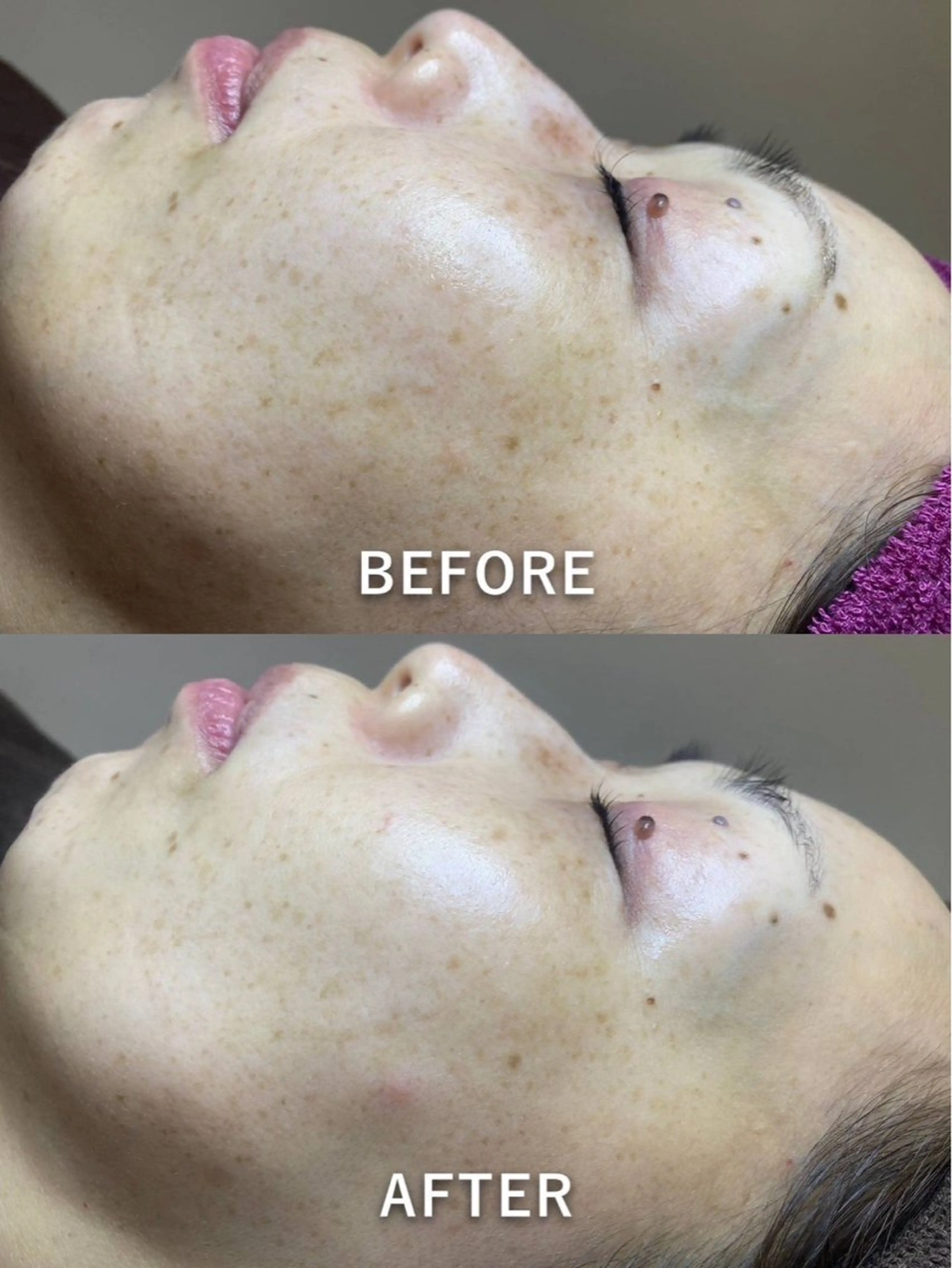 REMENTE池袋東口店所属・REMENTE🪞 KANAのエステ・リラクイメージ