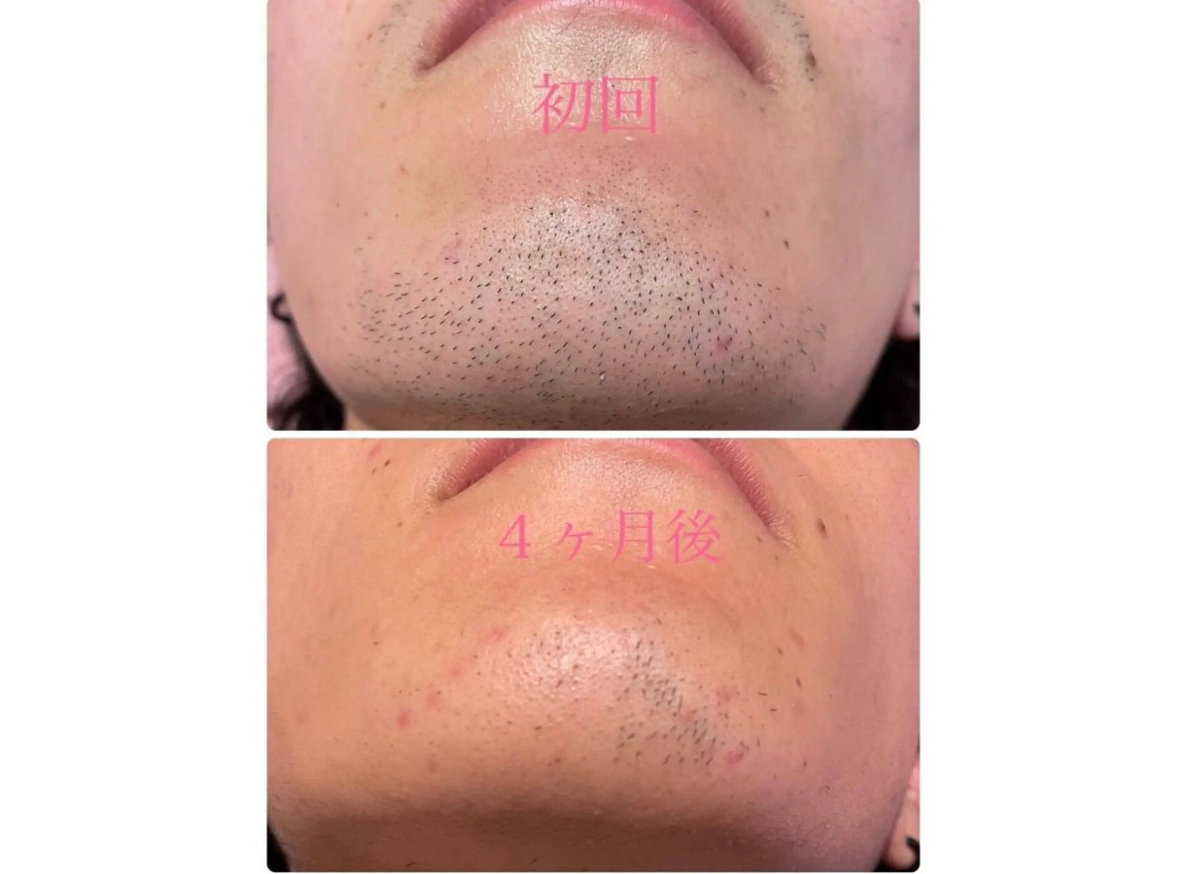 脱毛 RAY Beauty エステ　一宮店のエステ・リラクイメージ