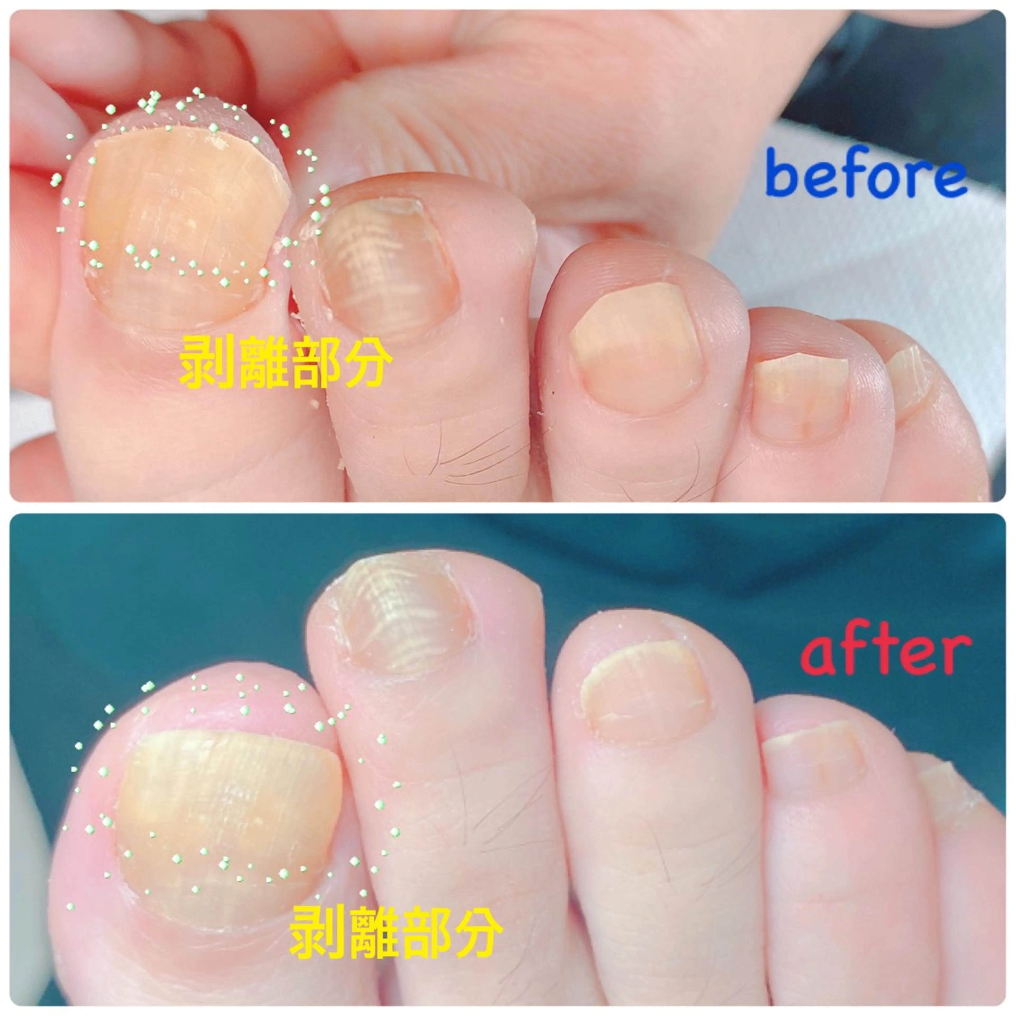 ネイル その他(ネイル) 柴崎 美幸のネイルデザイン