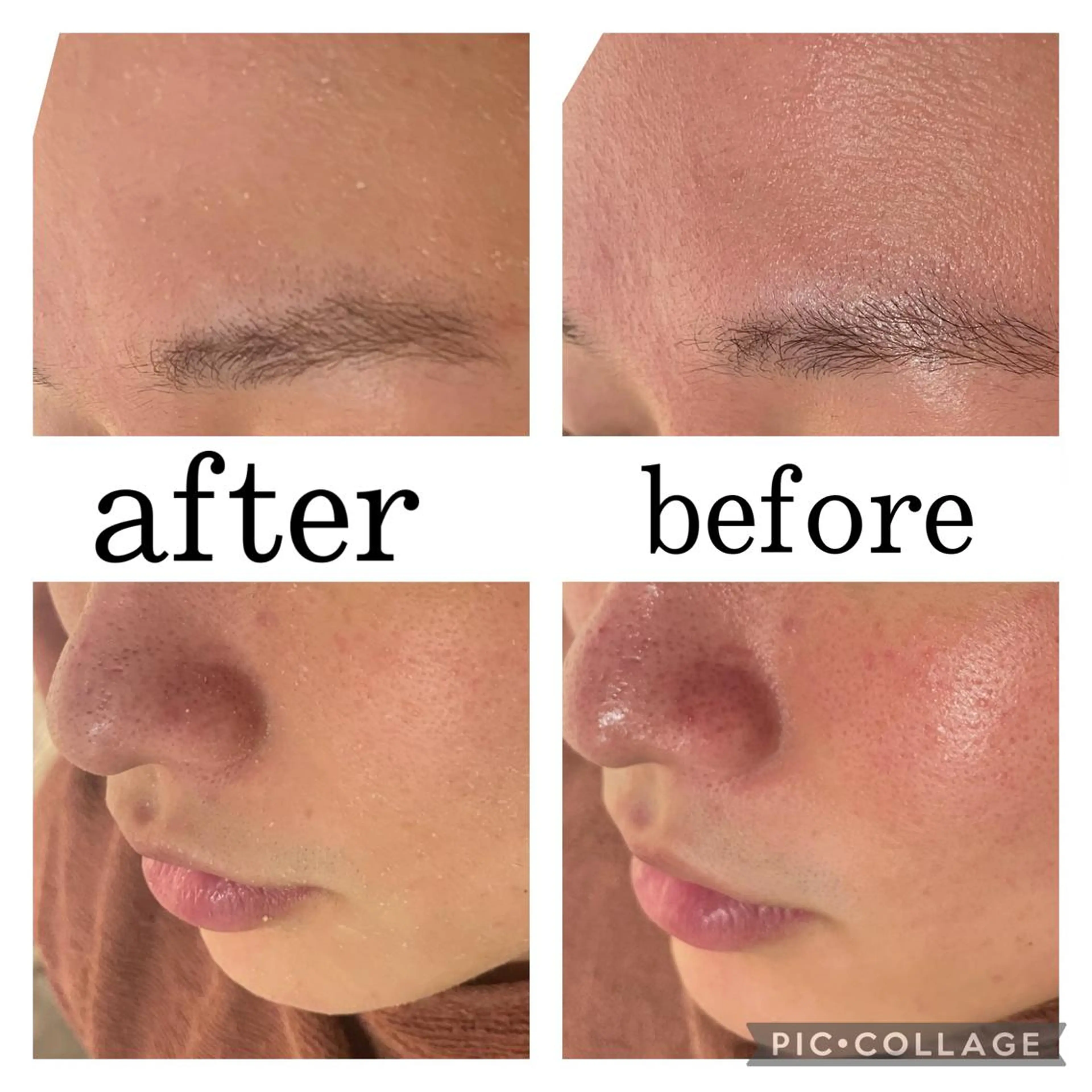 ロング カラー パーマ ヘアアレンジ メンズ キッズ ネイル マツエク・マツパ アイブロウ ニキビ特化型エステ 🍓最短で肌質改善のエステ・リラクイメージ