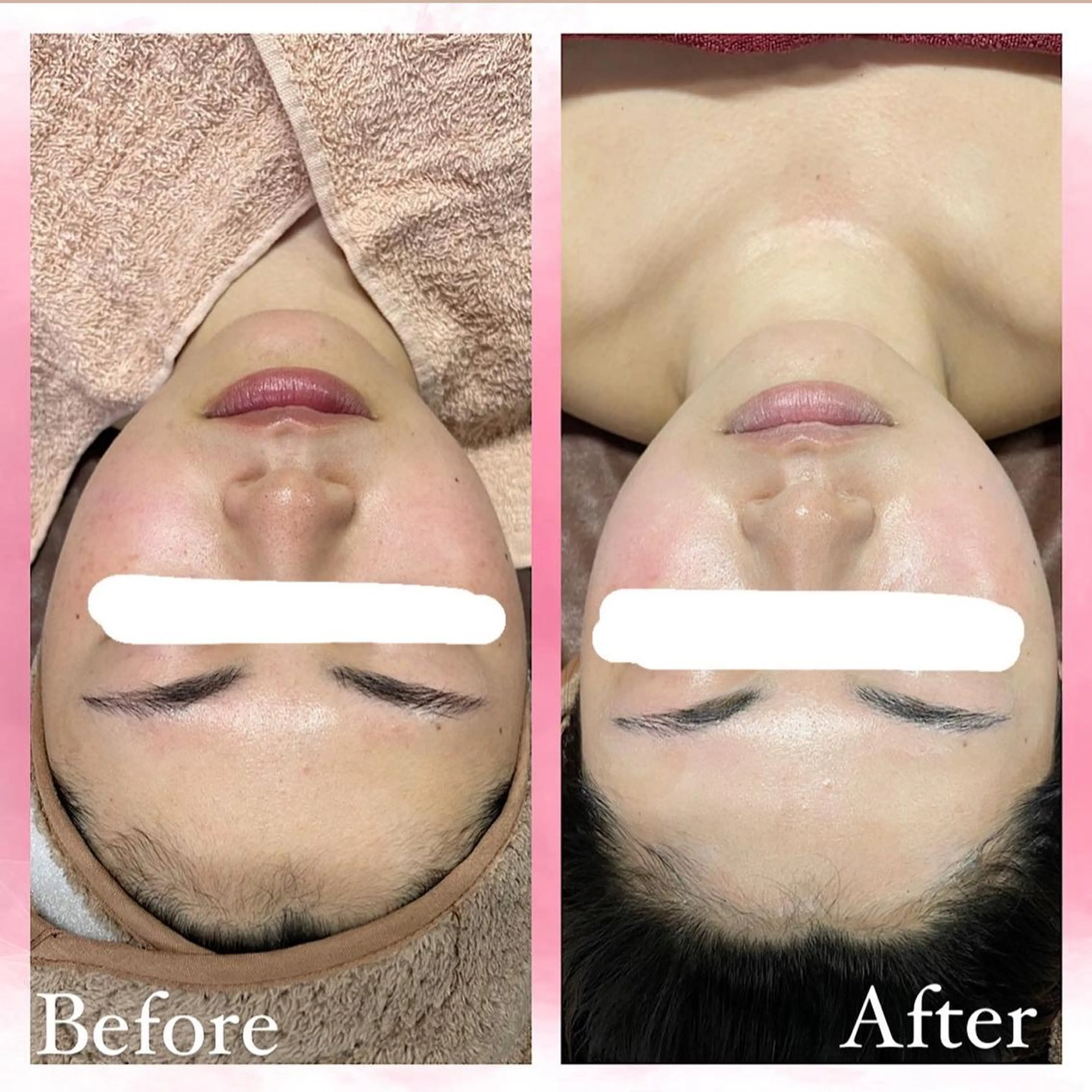 エステ salon〜RePCa〜(サロンルピカ)所属・山﨑 藍のエステ・リラクイメージ