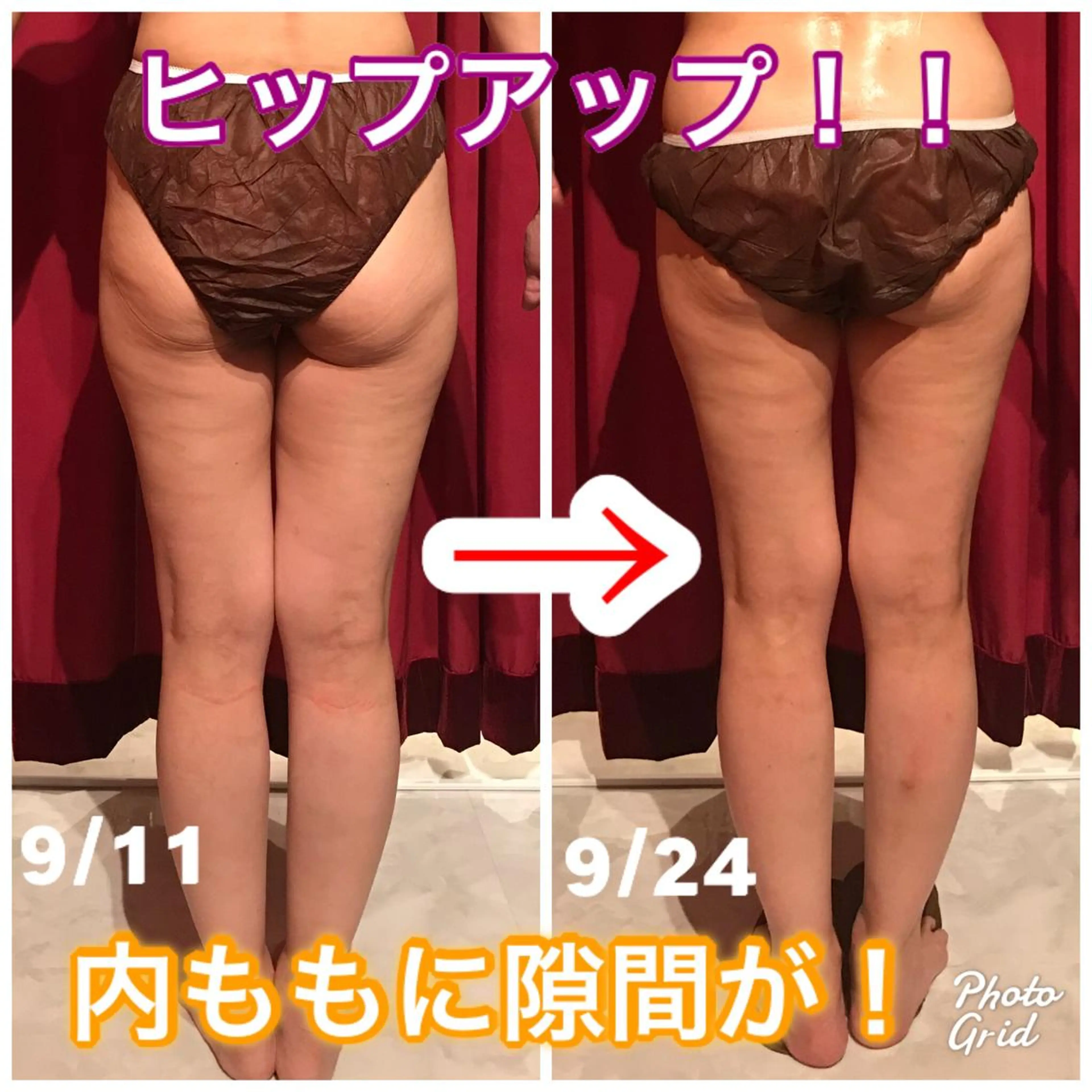 Cielo(シエロ) ダイエット専門店のエステ・リラクイメージ