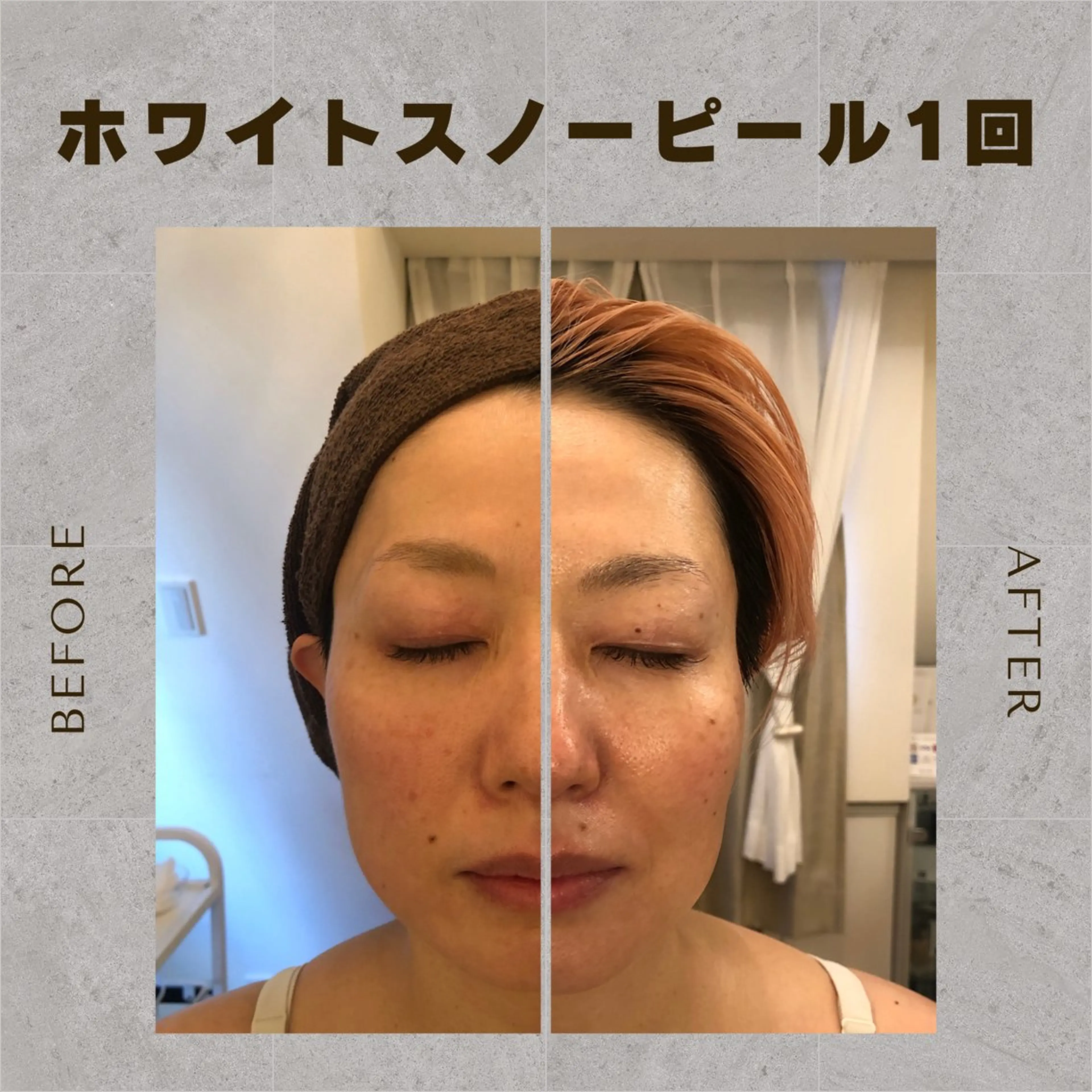 Salon de cheri サロンドシェリ人形町店所属・毛穴のお悩み・シミ 松本瞳のエステ・リラクイメージ