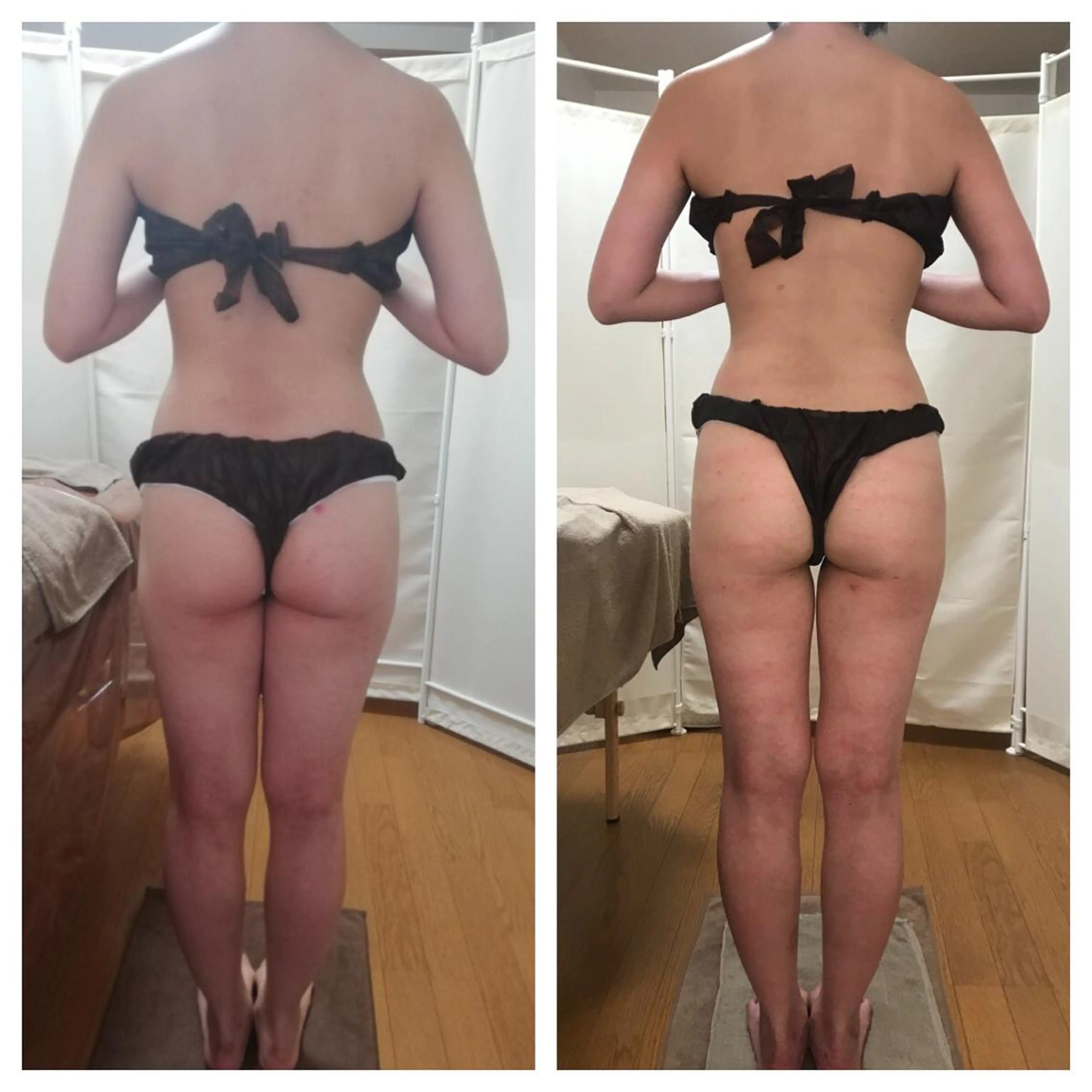 biloop所属・《痩身×疲労改善》 BILOOPのエステ・リラクイメージ