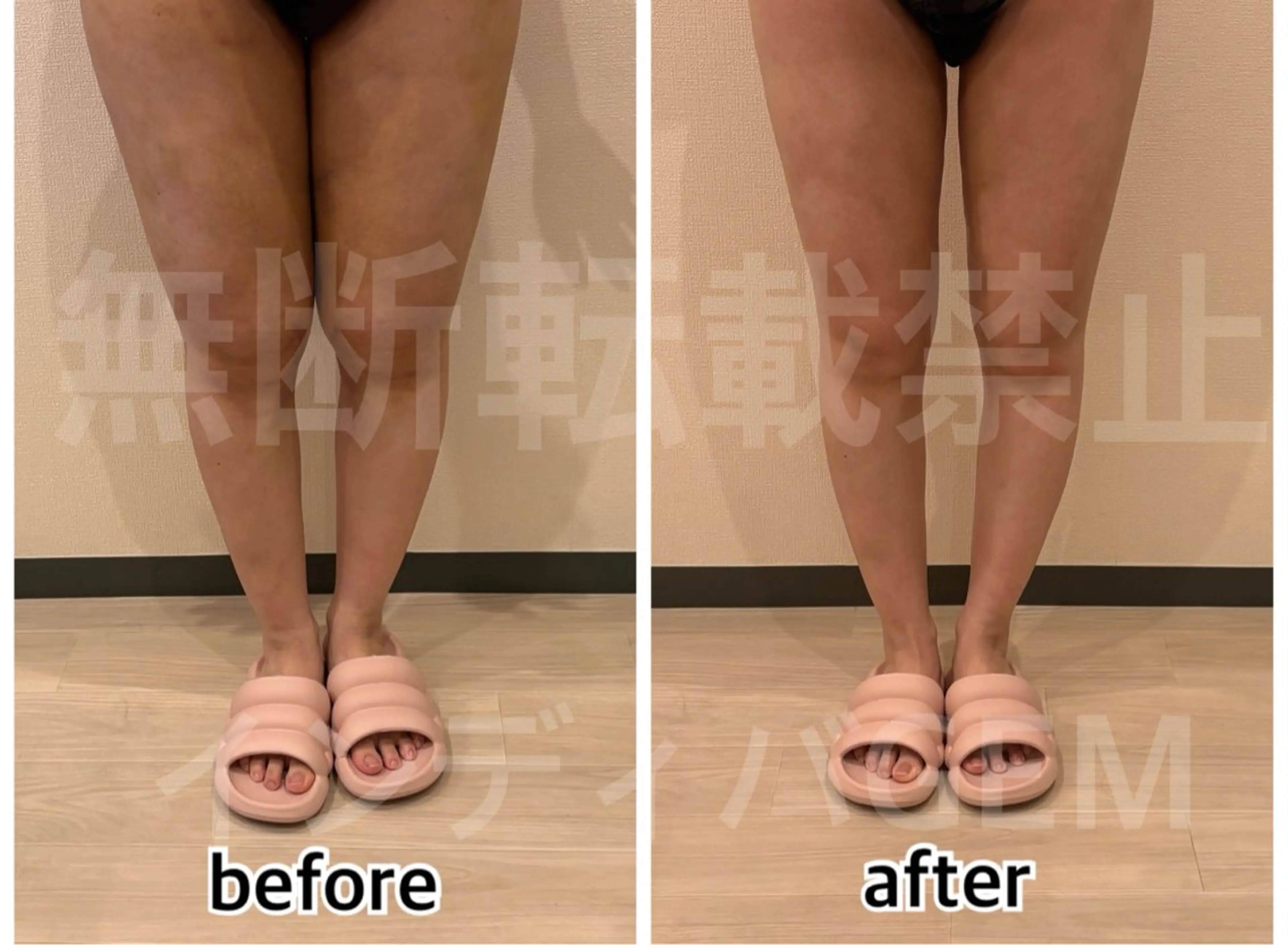 💎インディバ GEM💎indiba   healing room GEM所属・💎 GEM💎のエステ・リラクイメージ