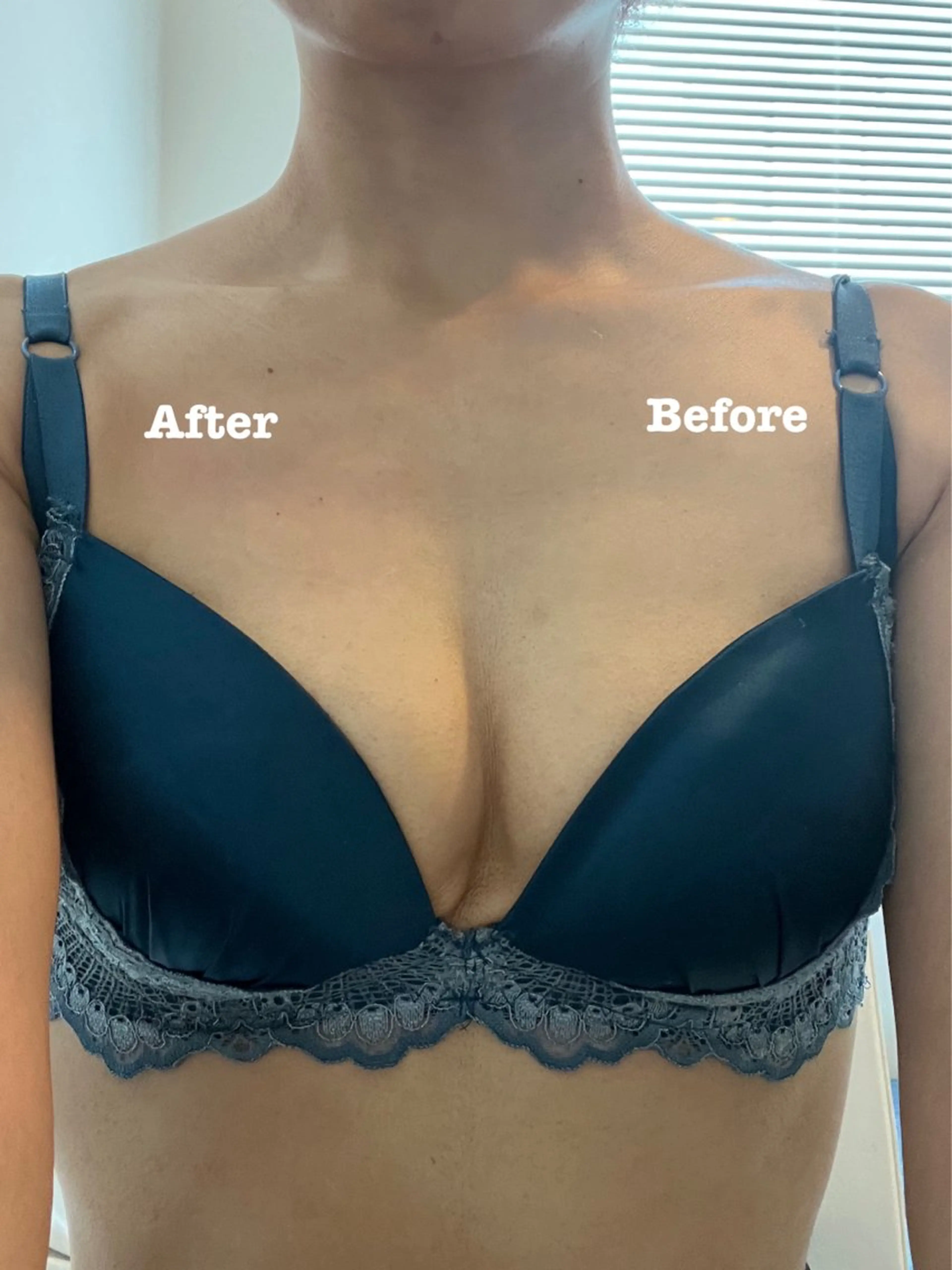 【minimo限定】マシュマロバスト　ふわふわバストアップケアの写真