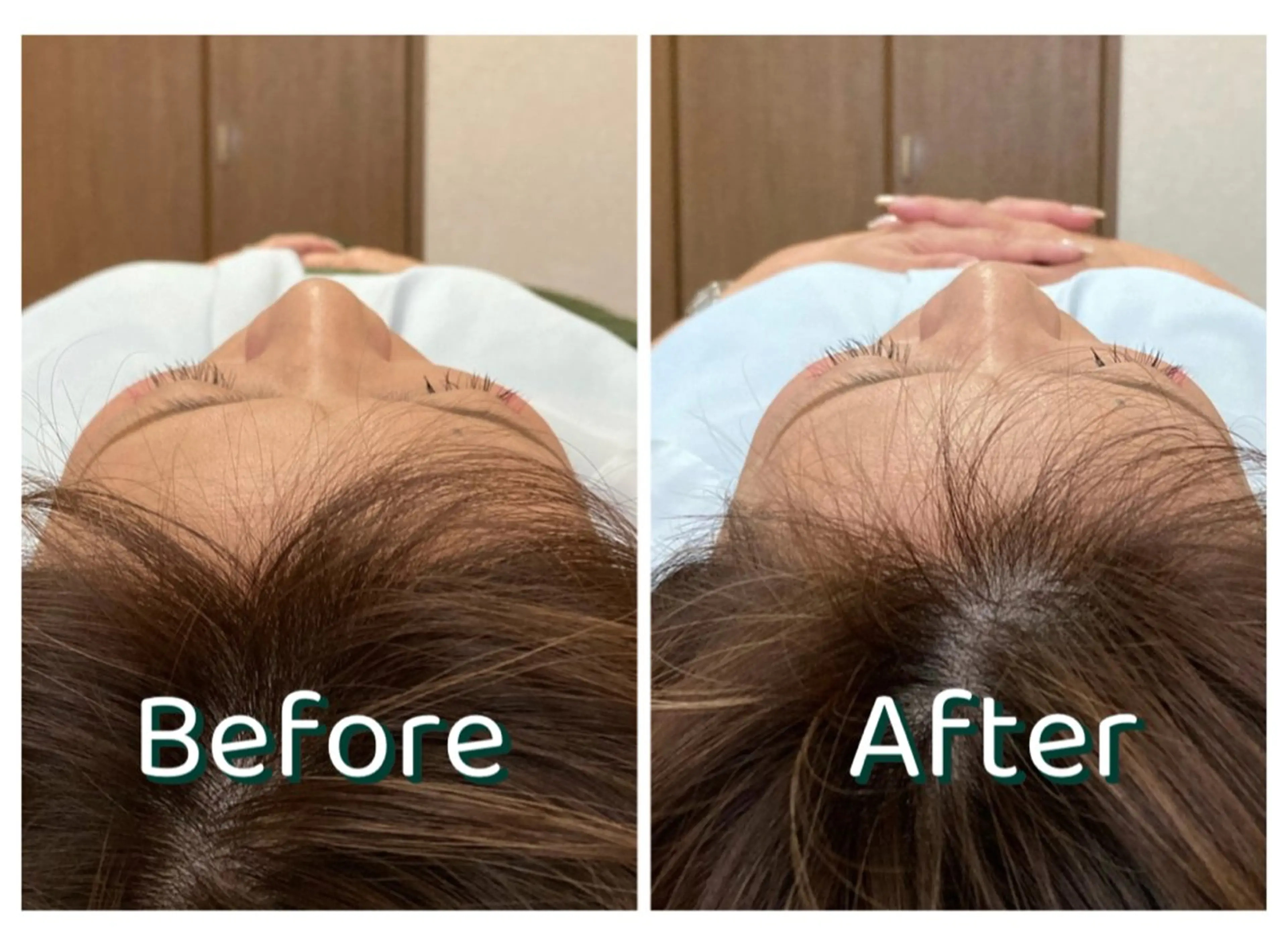 リラク TKサロン所属・TKサロン 柿沼のエステ・リラクイメージ