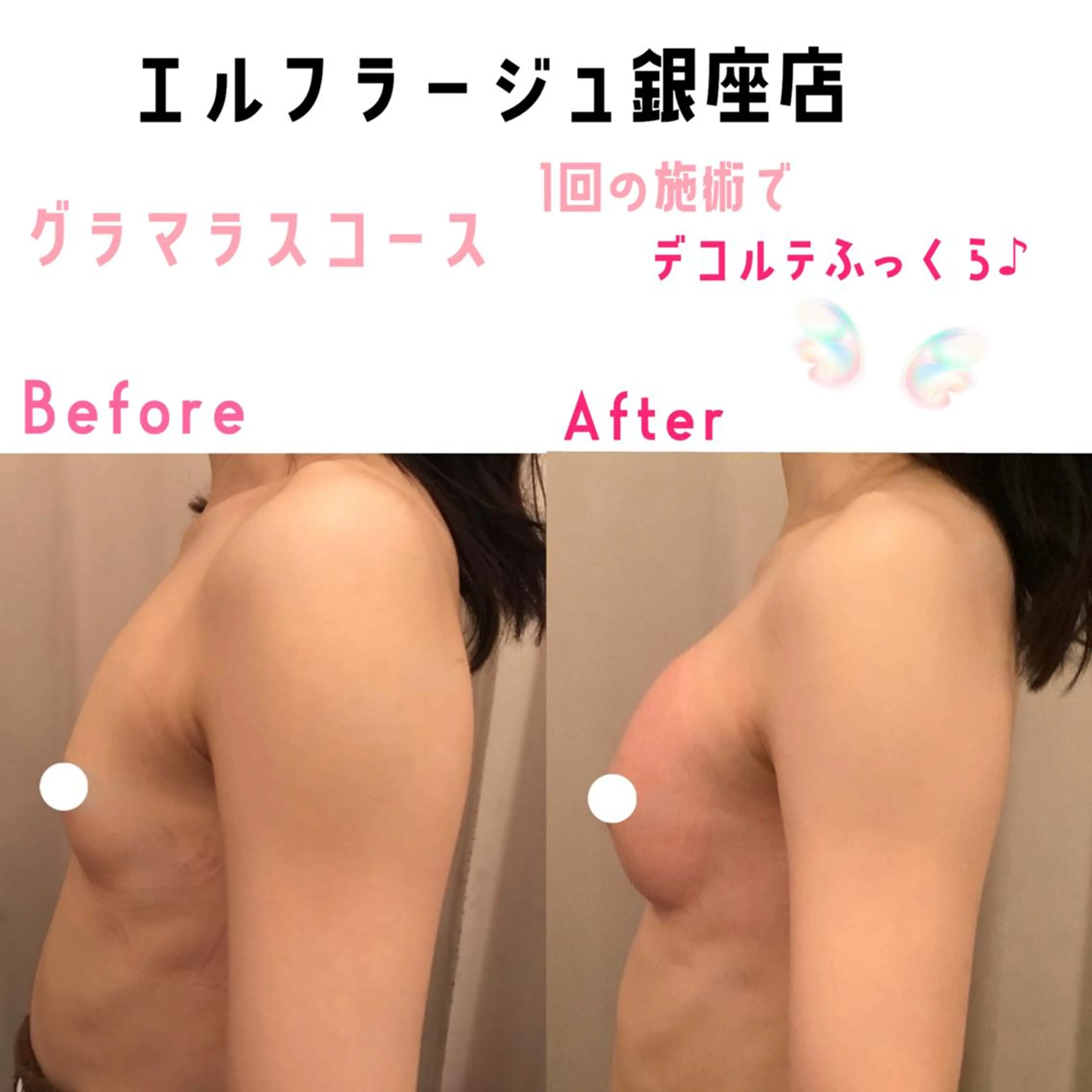 エルフラージュ 銀座店のエステ・リラクイメージ