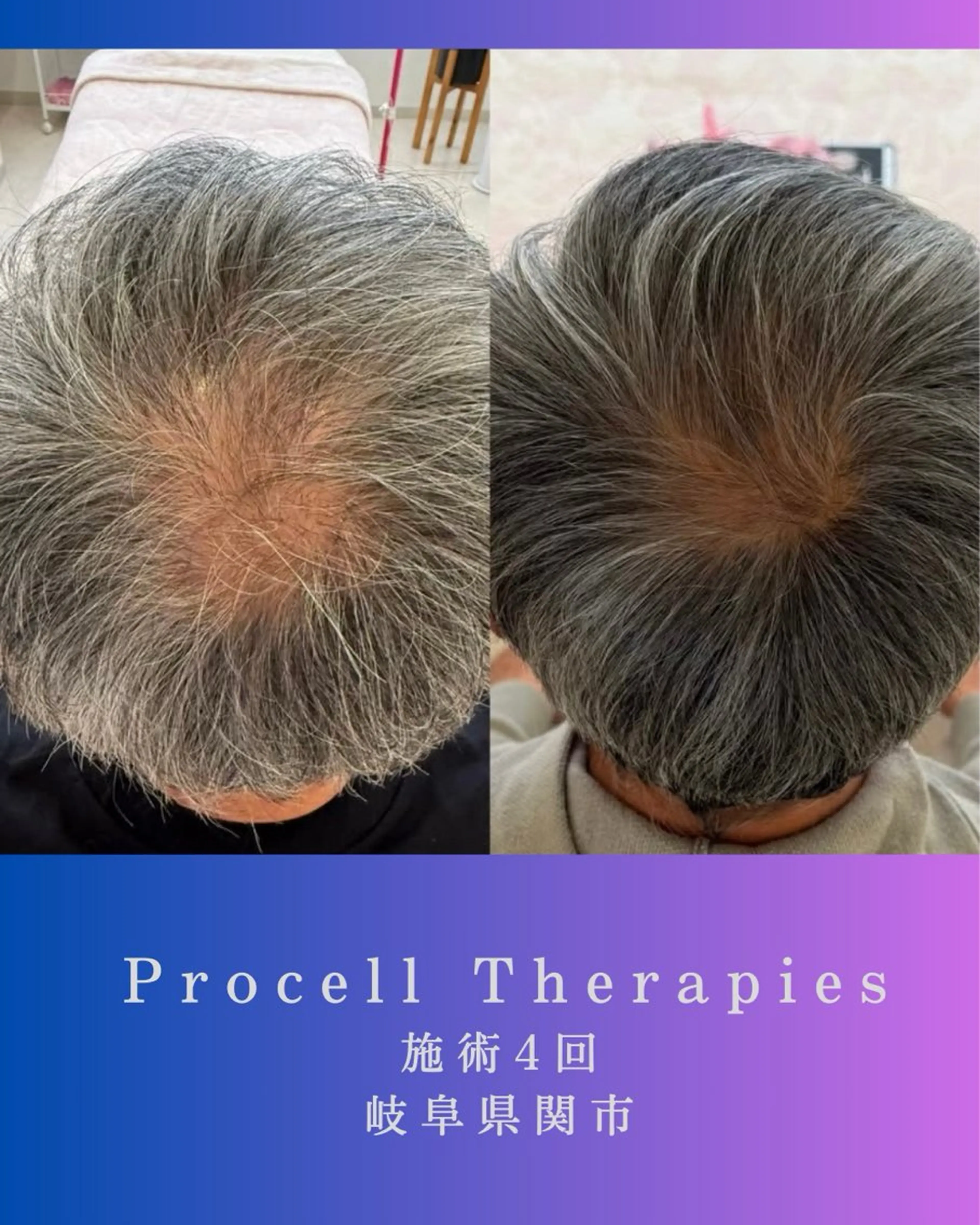 その他 氣楽所属・松下 さゆりのエステ・リラクイメージ