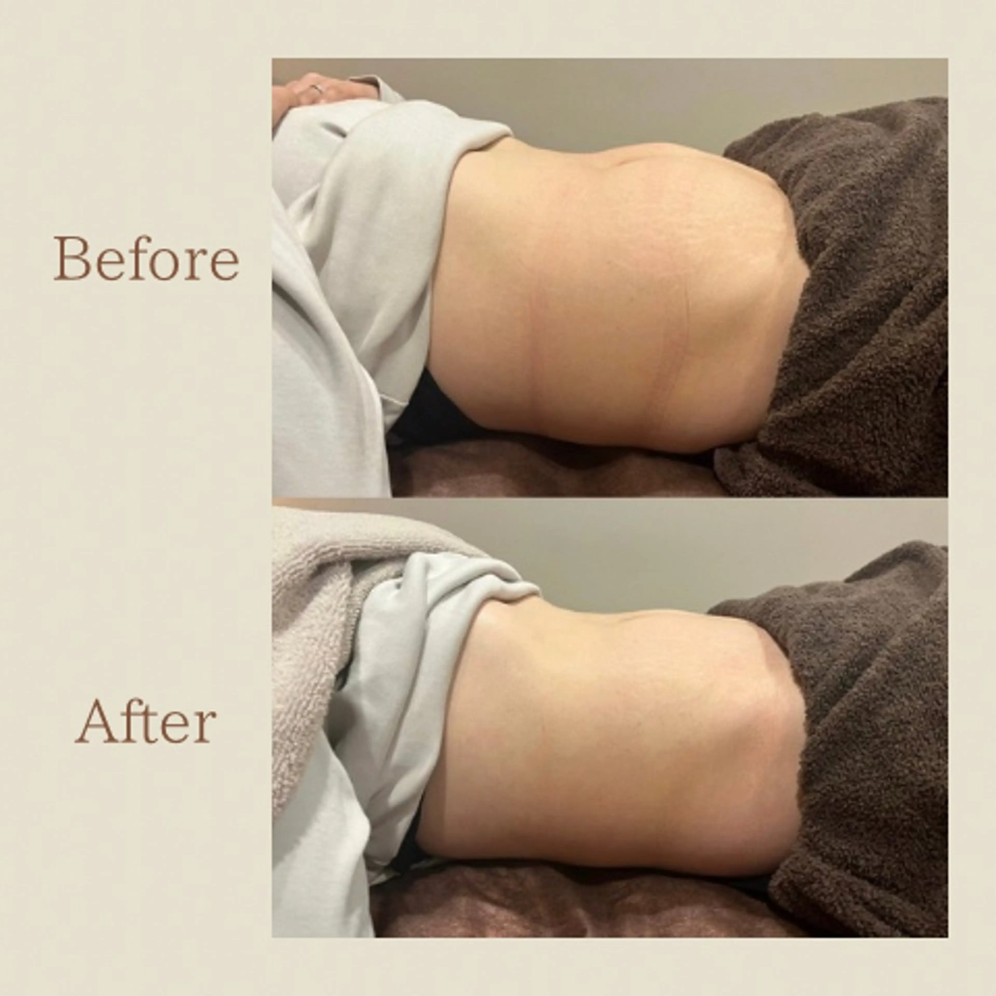 お腹痩せエステ Flat BELLY 恵比寿所属・【腸もみ/冷却痩身】 お腹エステ/恵比寿のエステ・リラクイメージ