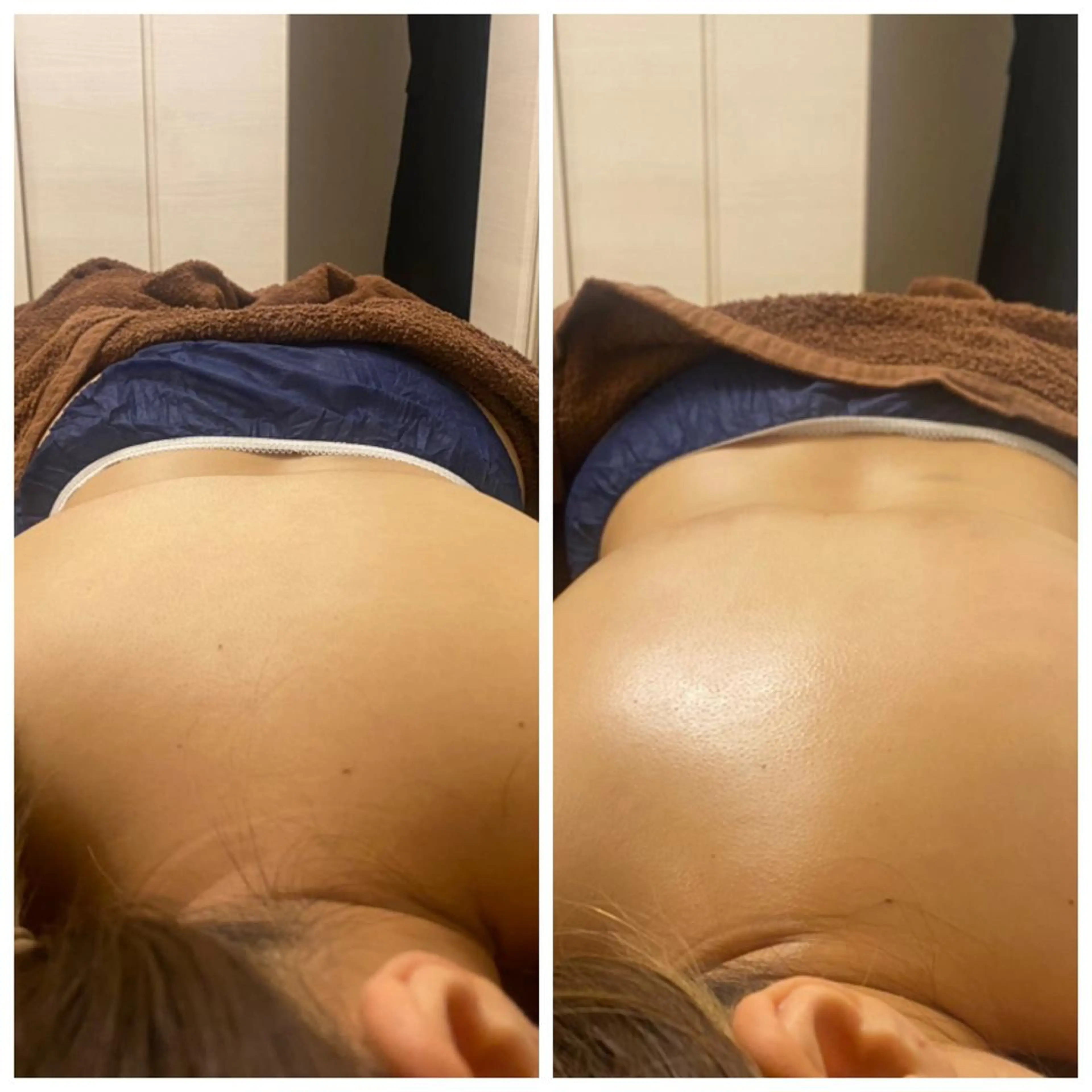 エステ リラク Nadia〜body &facial salon〜所属・【肌質改善】 ハーブピーリングのエステ・リラクイメージ