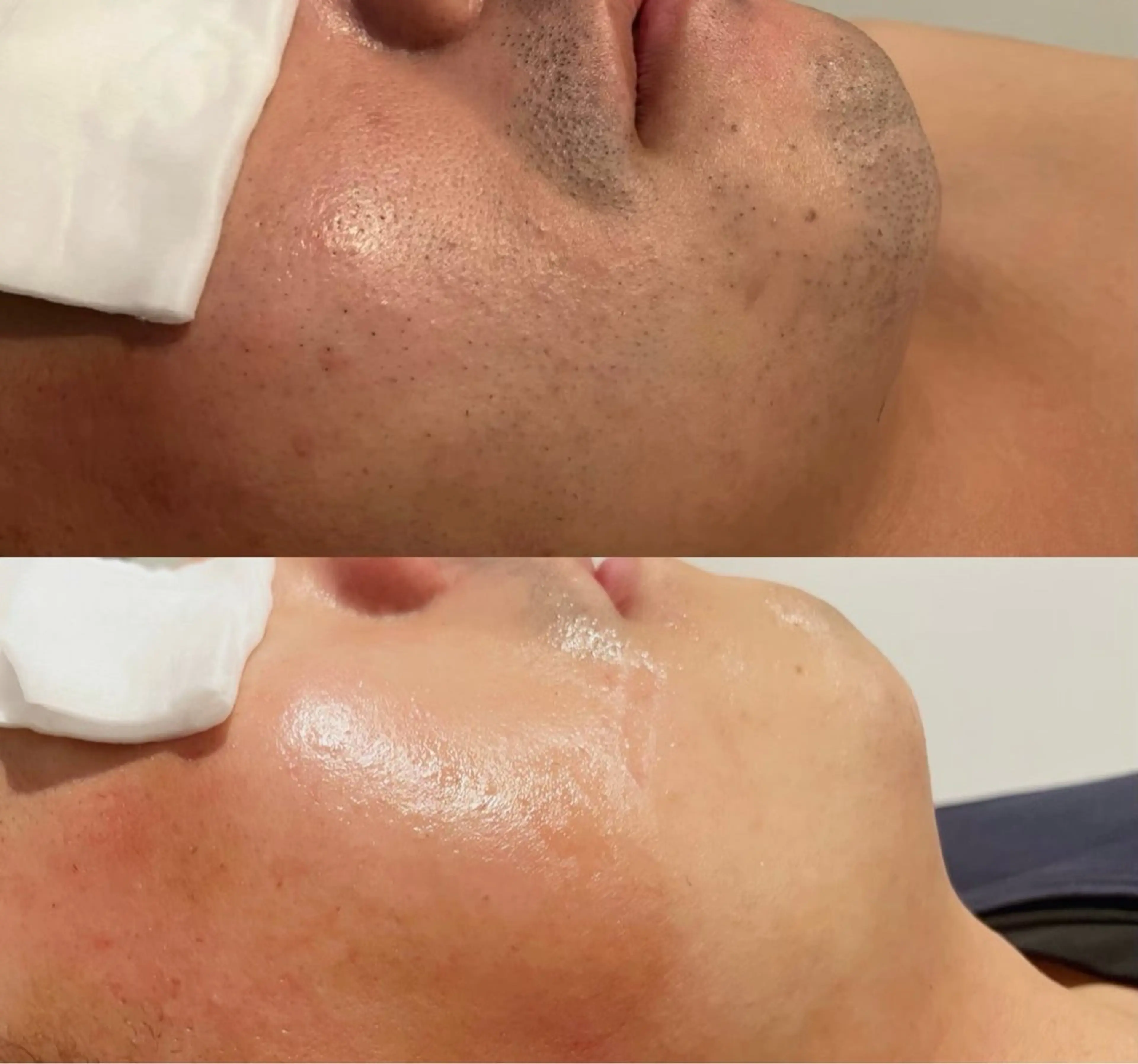 メンズ 脱毛 Butterfly 平塚店　佐藤のエステ・リラクイメージ