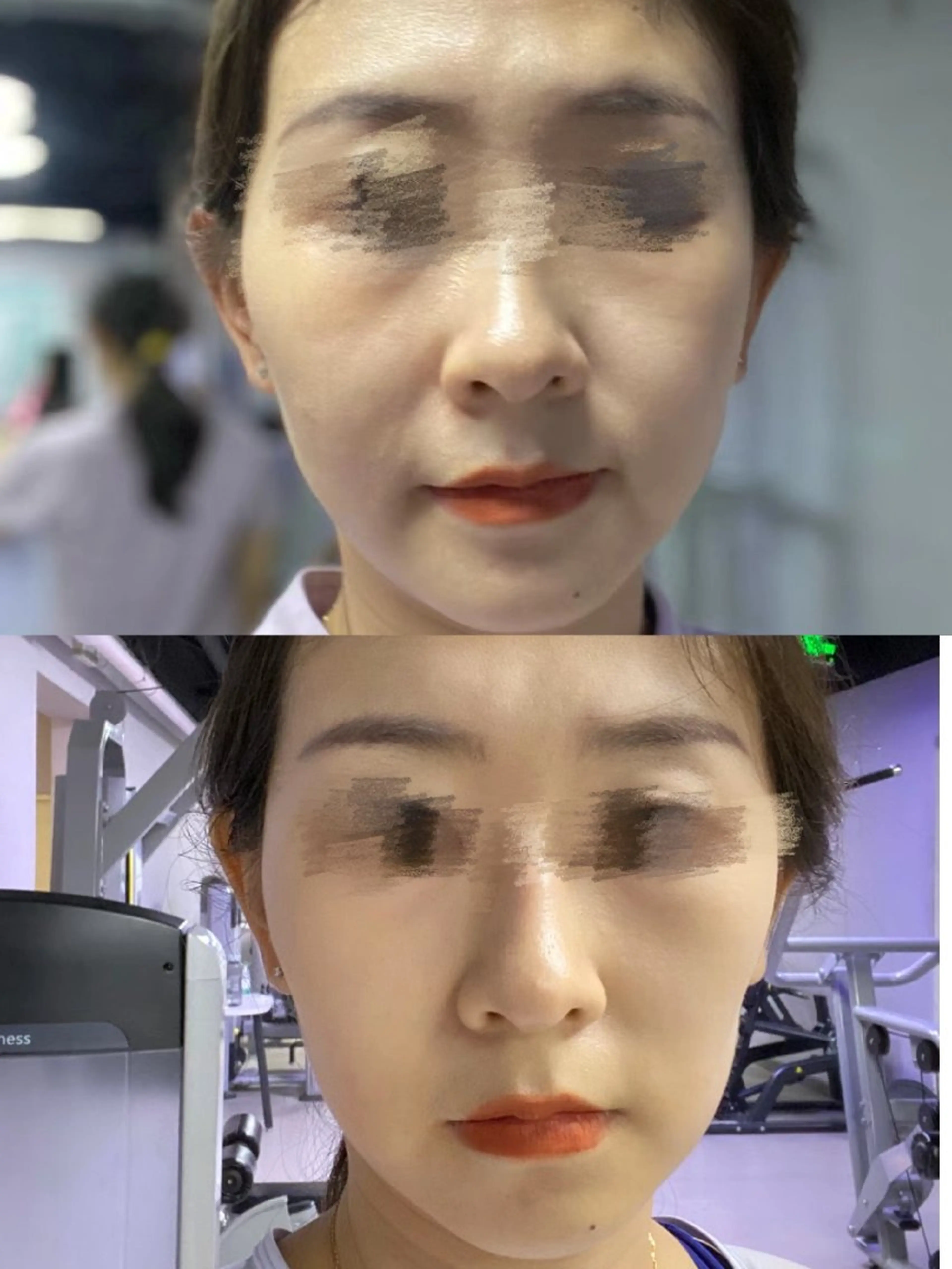 マツエク・マツパ 韓国風マツエク 結婚式・ブライダル aliaハイフ&水光ジェットサロン所属・aliaハーブ水光店 エステティシャン募集のエステ・リラクイメージ