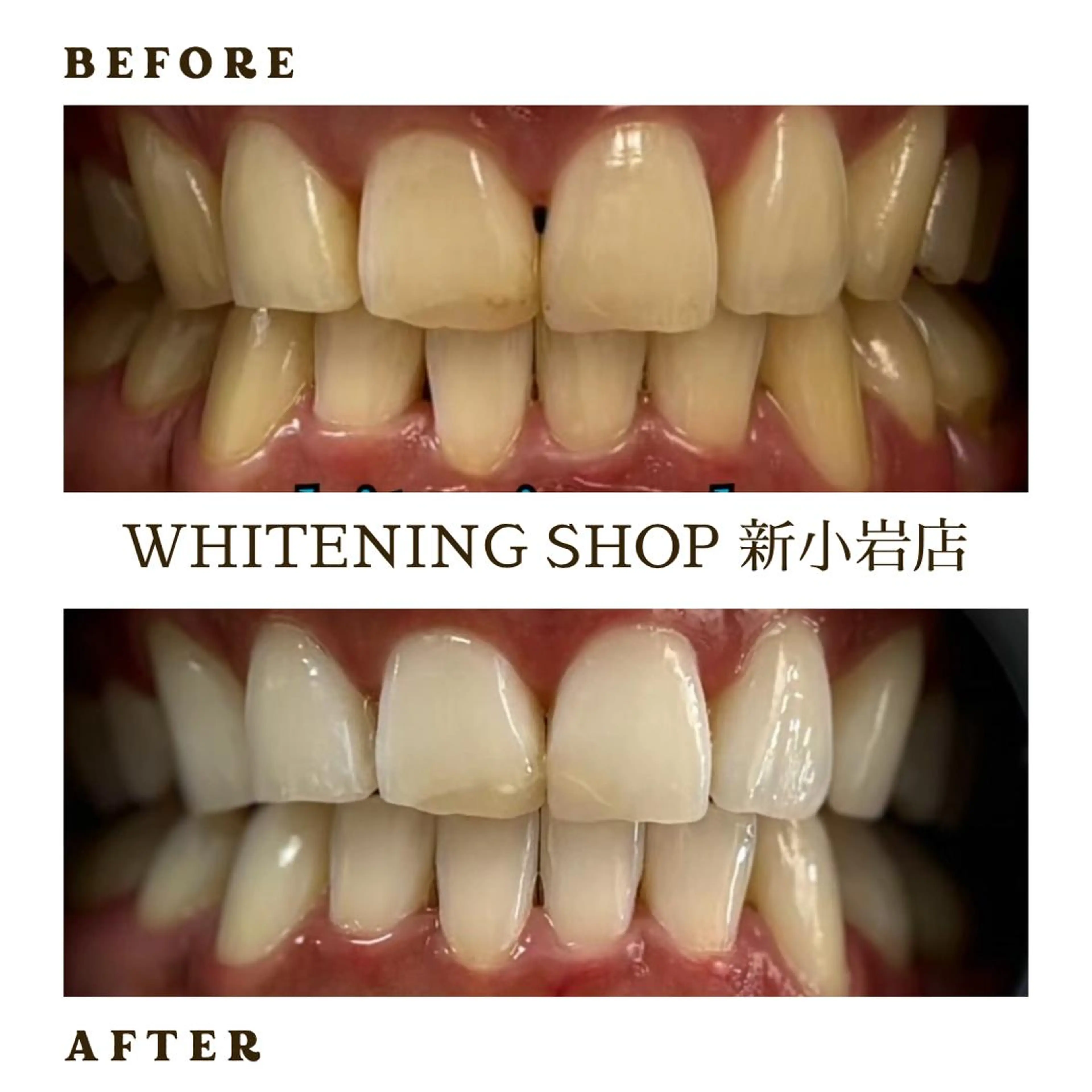 メンズ その他 ホワイトニング ショップ新小岩店のその他イメージ