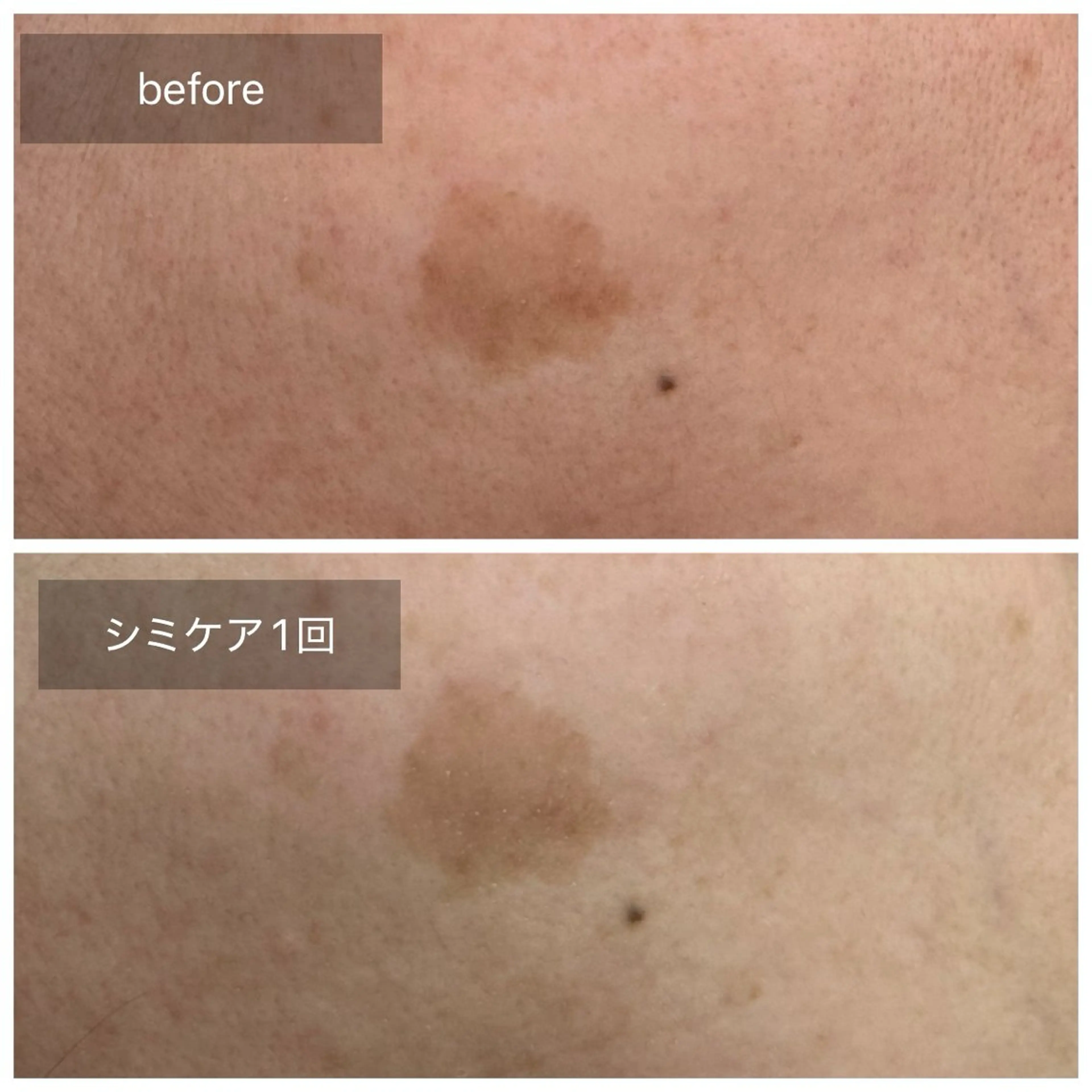 エステ トータルしみケア専門 NICA(ニカ)の眉毛・アイブロウイメージ