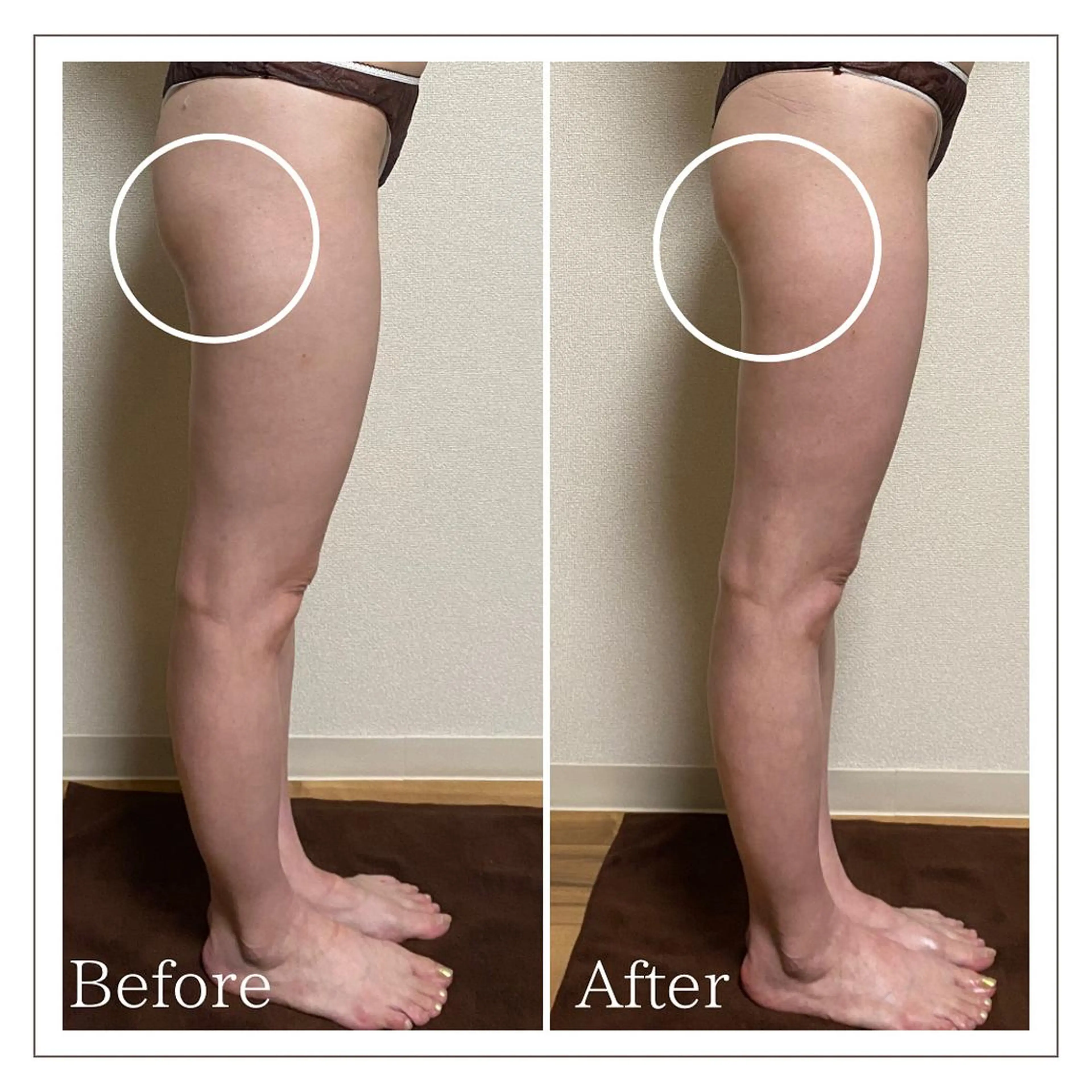 Luca所属・Luca ﾙｶのエステ・リラクイメージ