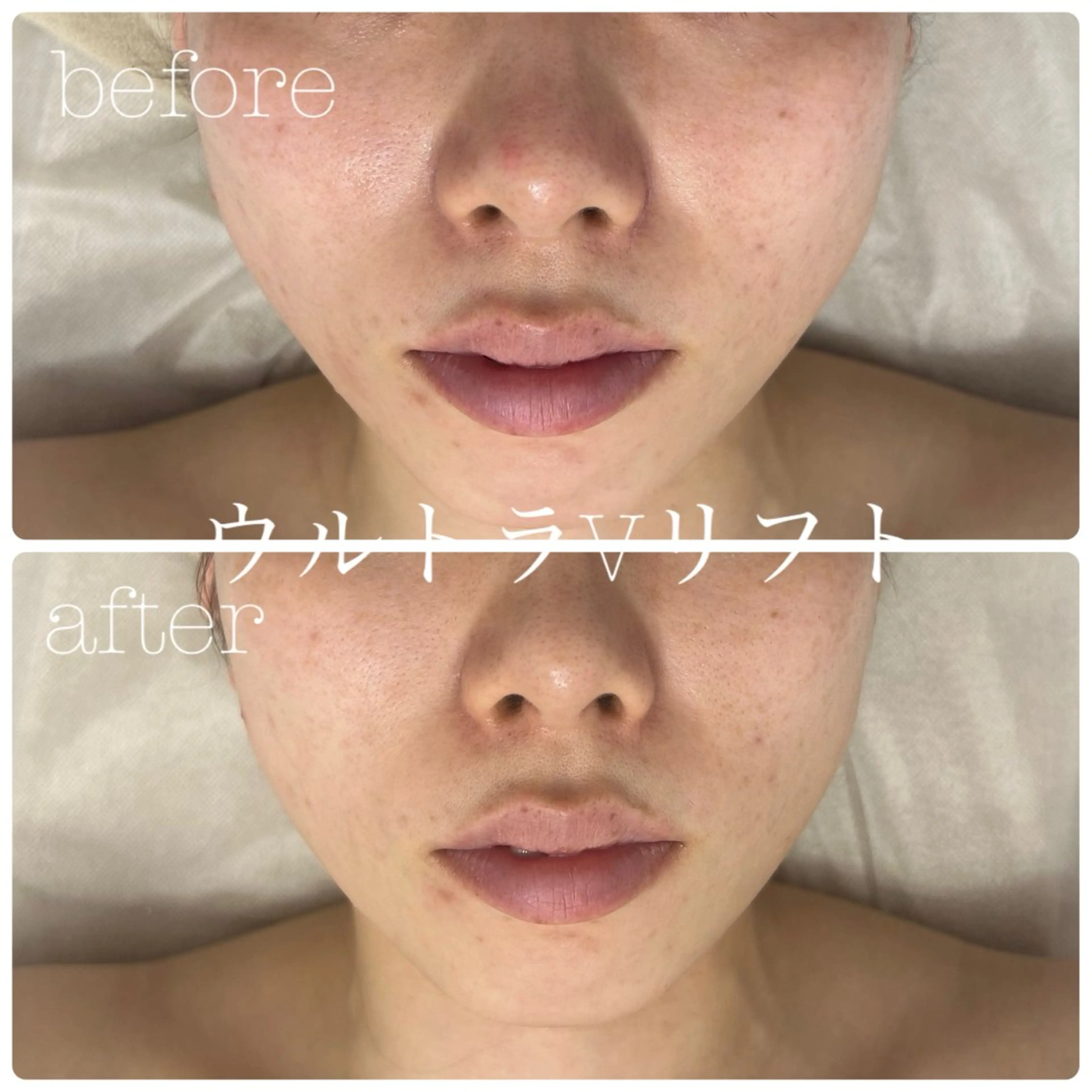 エステ フェイシャルサロン CHIARA 荒田のエステ・リラクイメージ