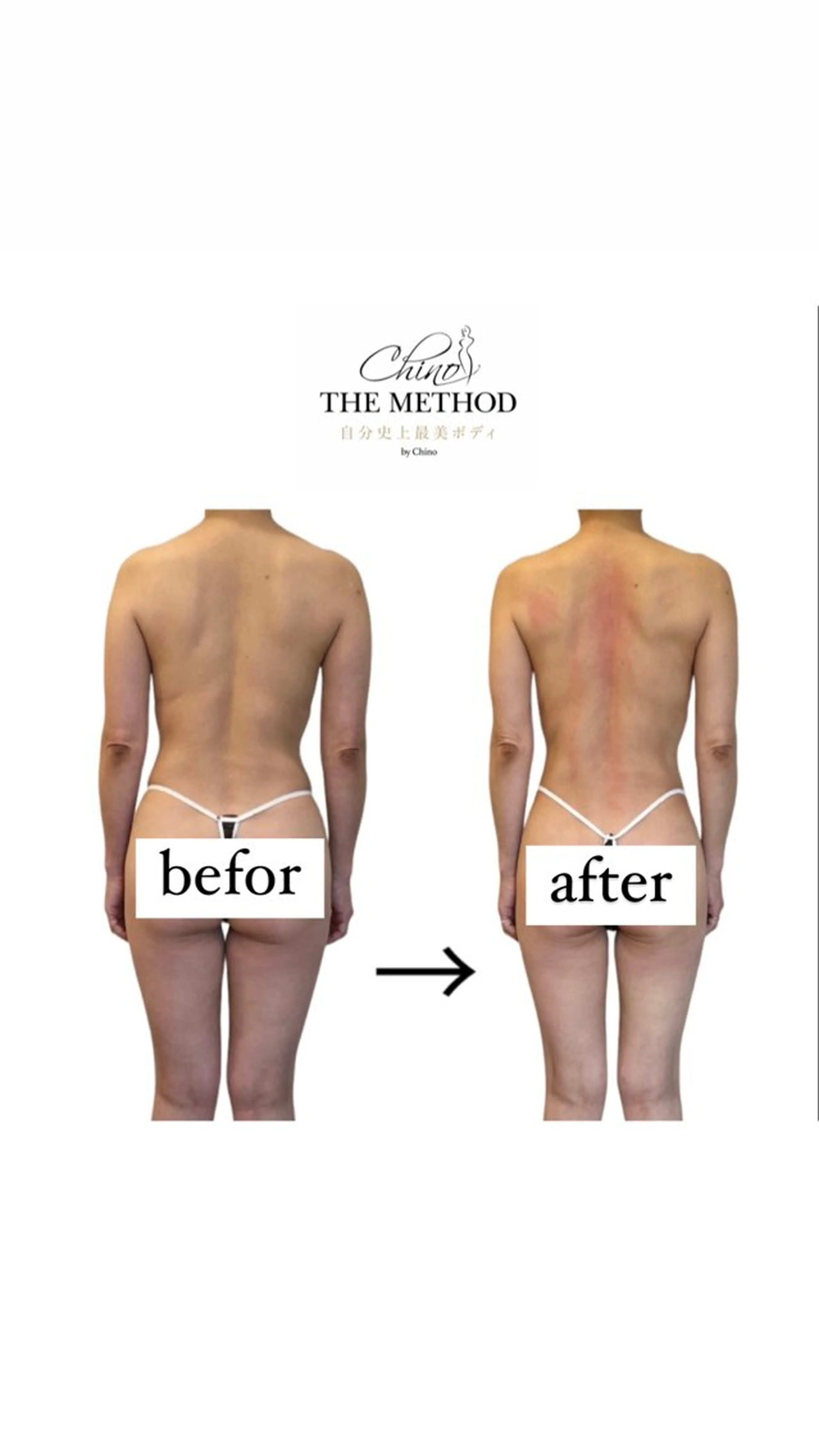 chino themethod(チノザメソッド)美骨矯正ボディーコースの写真