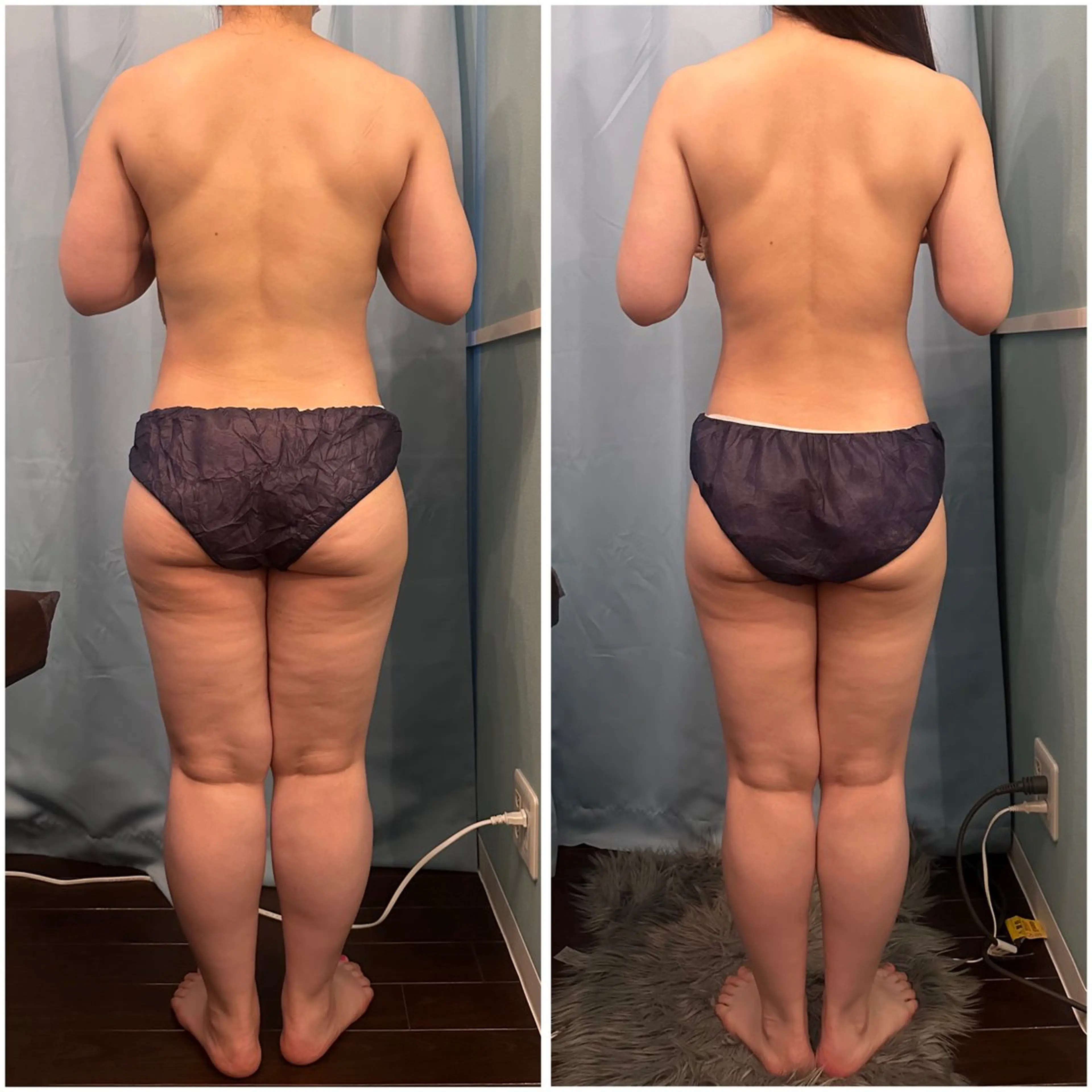 内側から変わる本気のダイエット❤️‍🔥排泄出来る身体に🔄15回144000円▶︎▶︎96000円(35％OFF)の写真