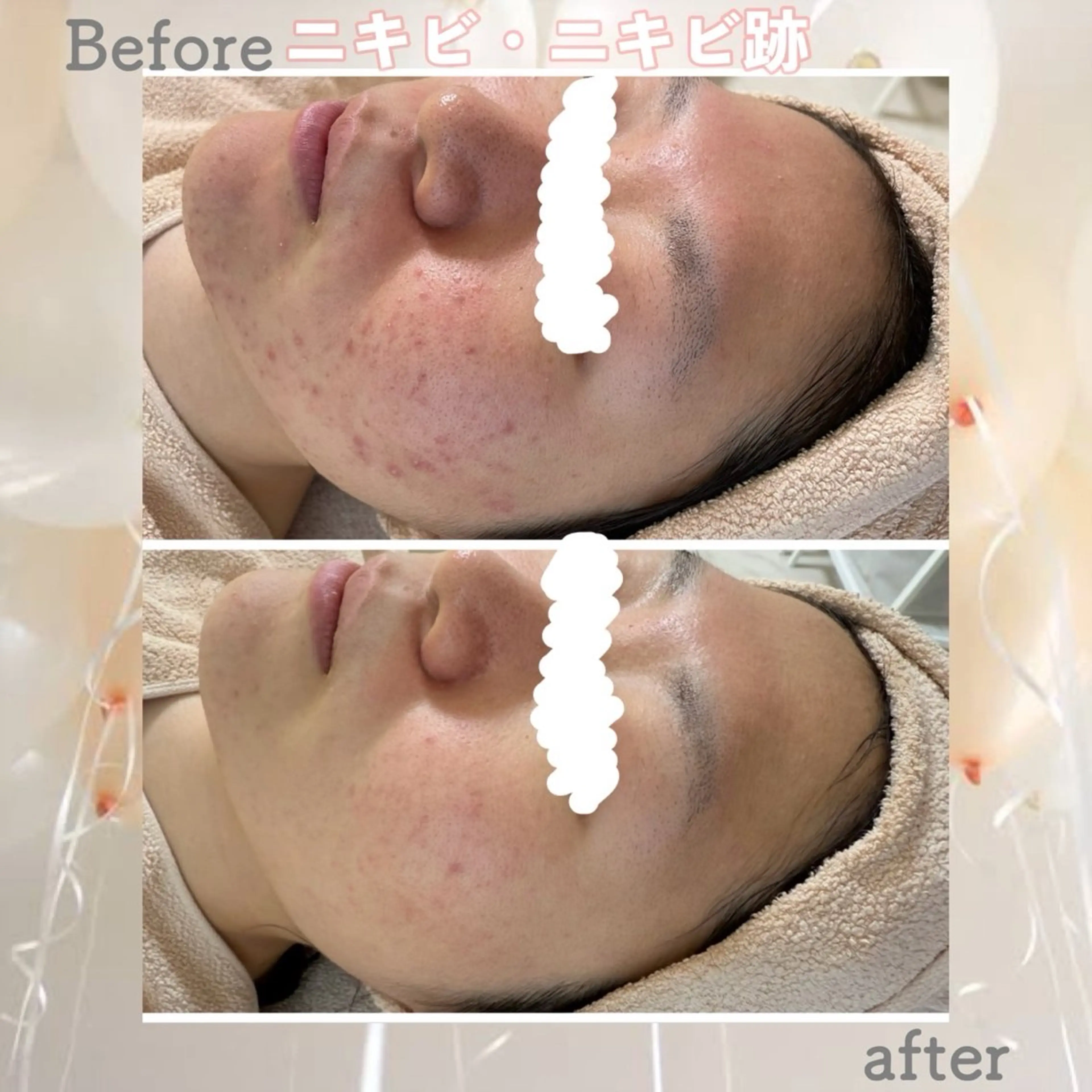 都度払い肌改善専門店 店長二上文香のエステ・リラクイメージ