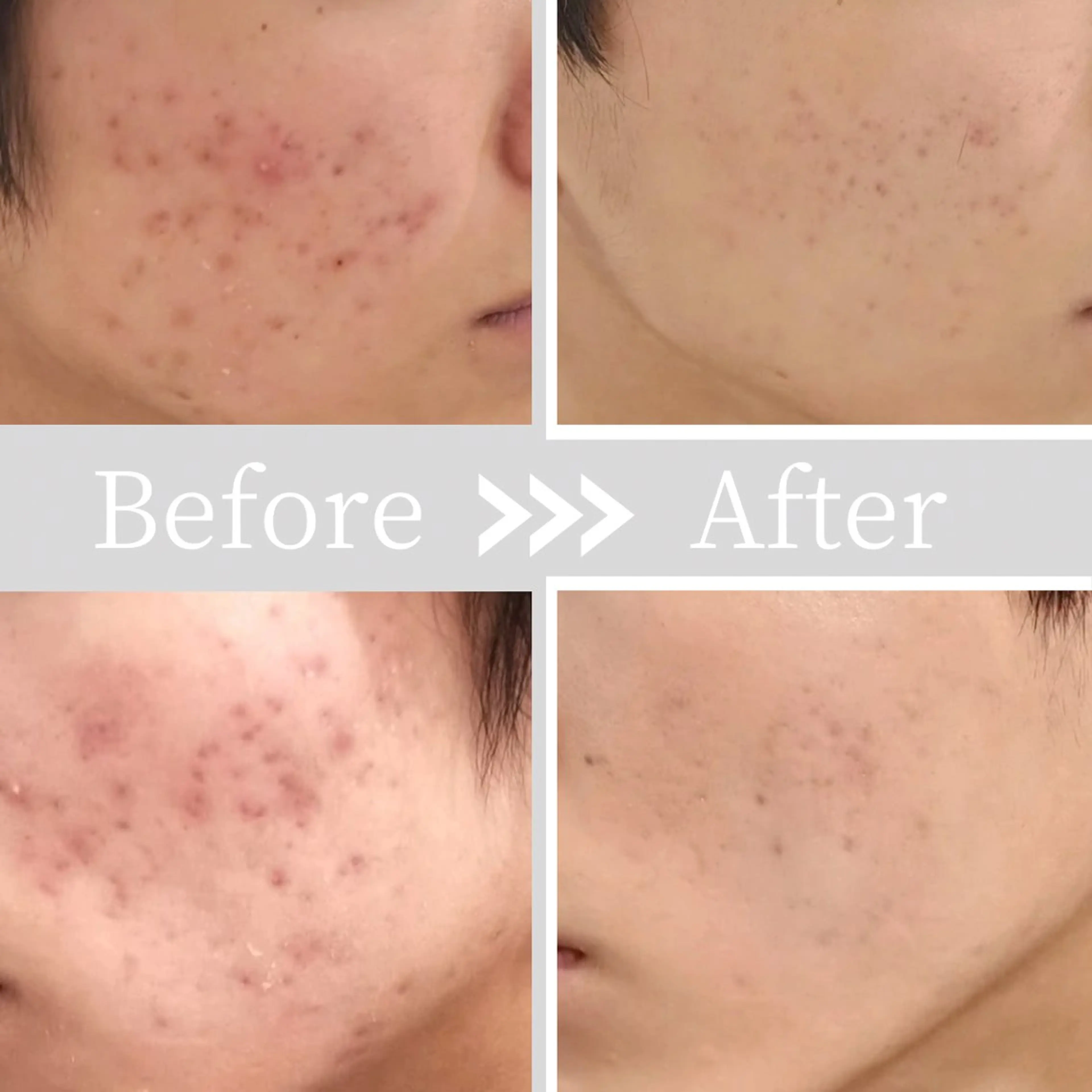 小顔・ツルツル素肌 ハリステリアのエステ・リラクイメージ