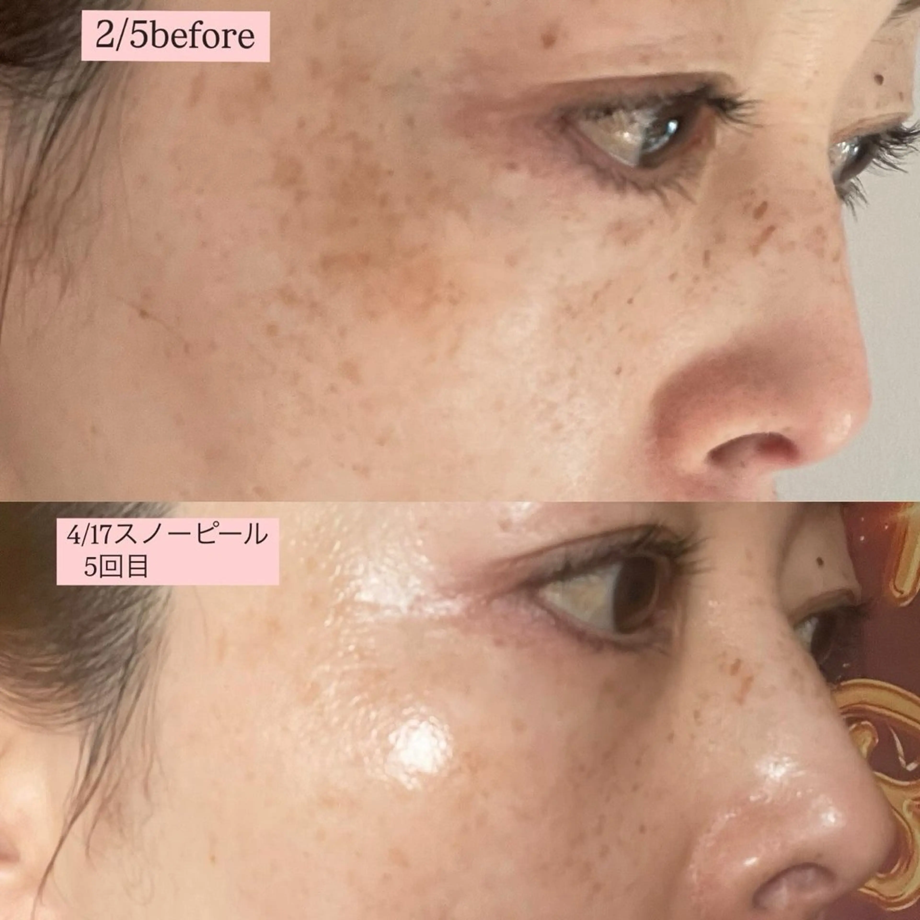 フィユ所属・〚博多〛フィユ 水江のマツエク・マツパデザイン