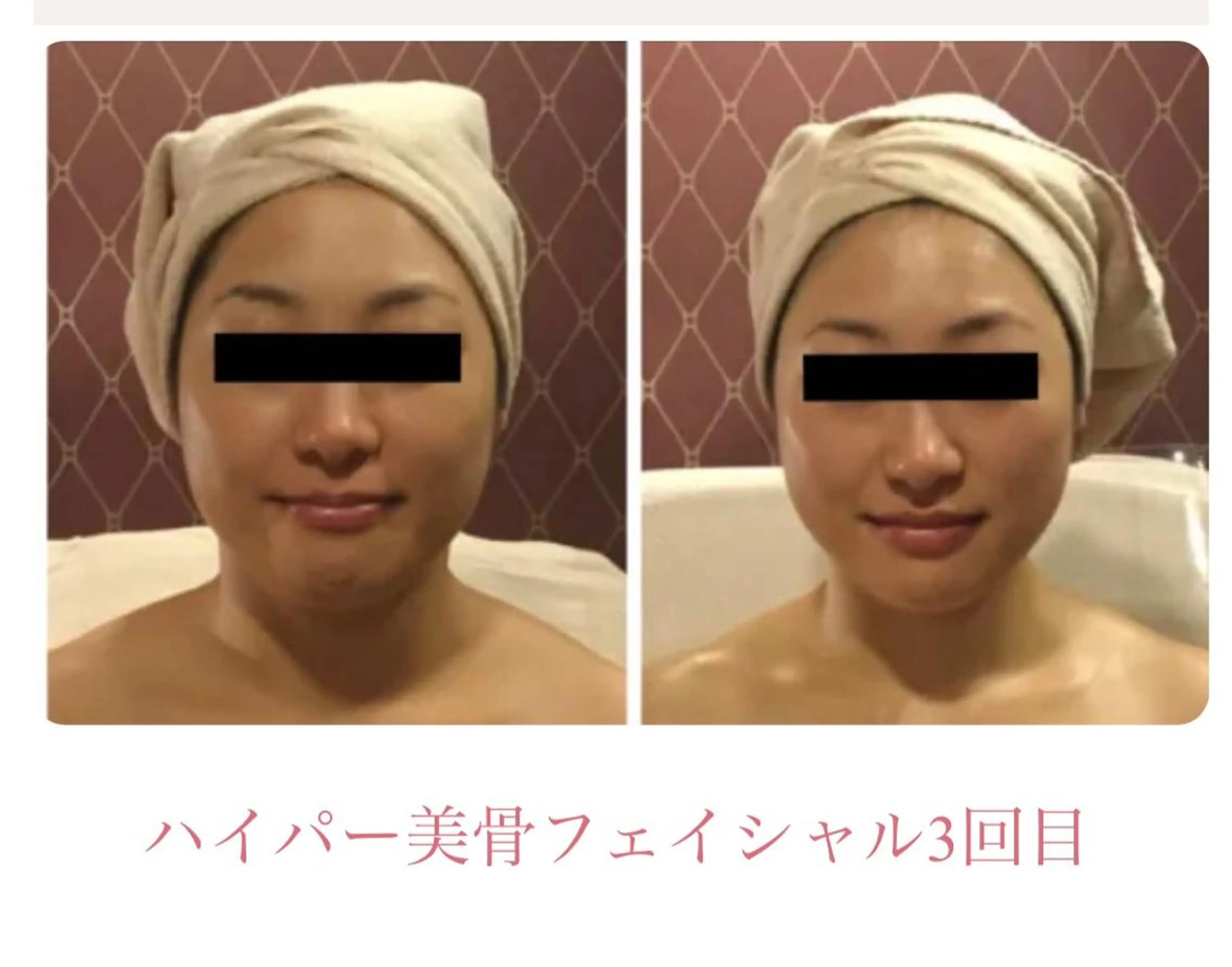 DEA  LUCE所属・痩身&小顔エステ DEA   LUCEのエステ・リラクイメージ