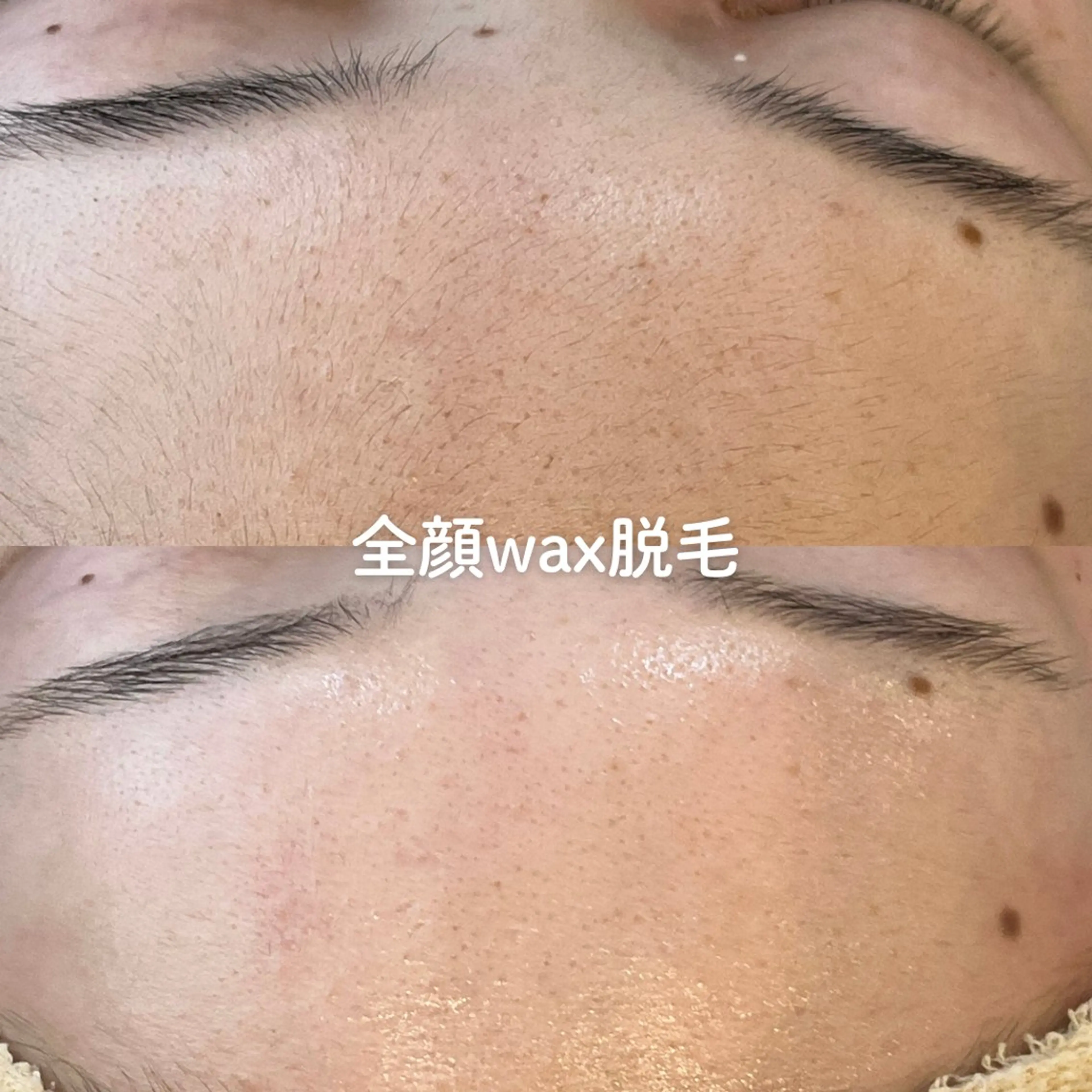 EST BEAUTY所属・顔ワックス脱毛/ ハーブピーリングのエステ・リラクイメージ