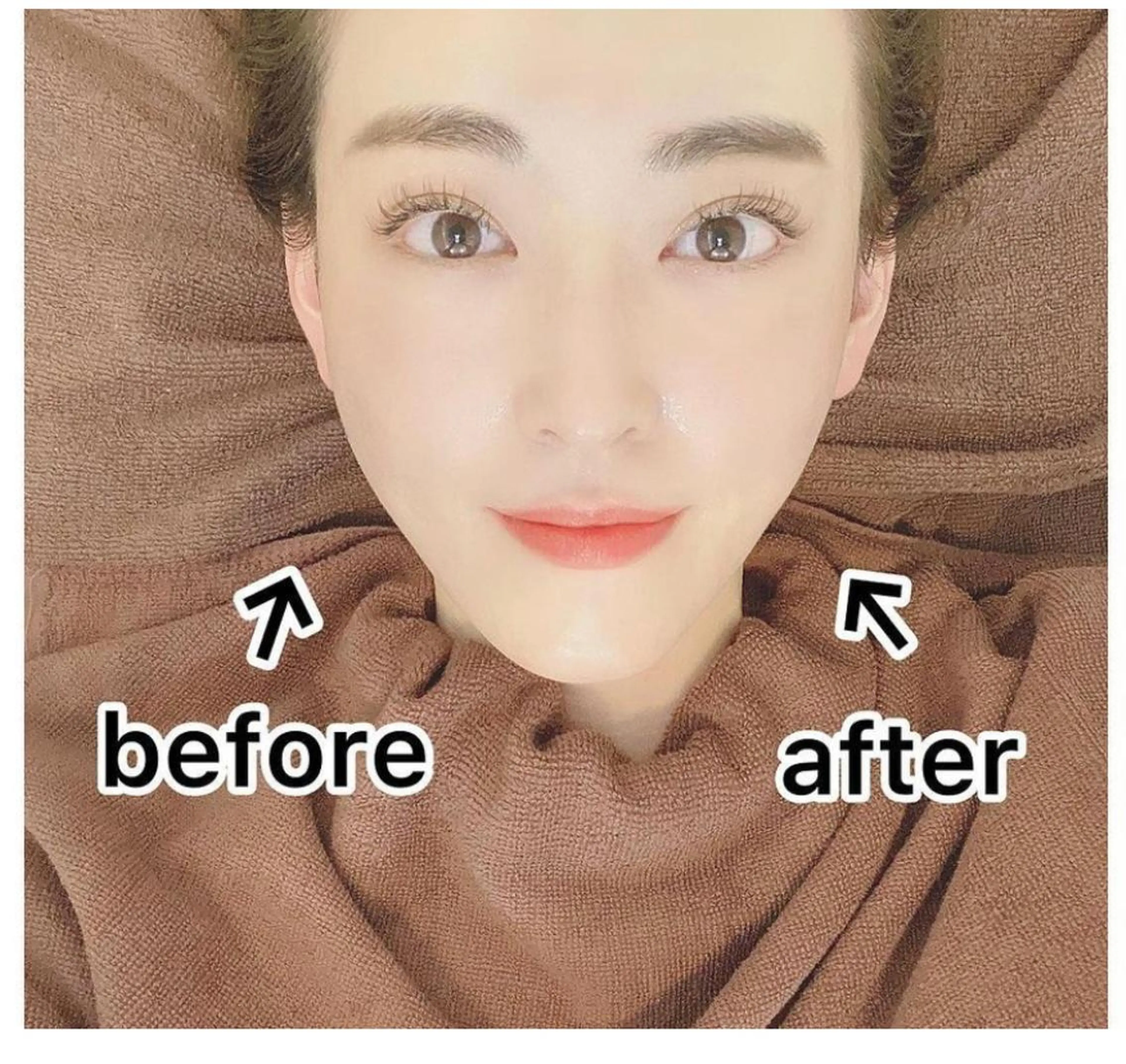 エステ Chalon所属・REVI取扱・肌悩み 毛穴Chalonのエステ・リラクイメージ