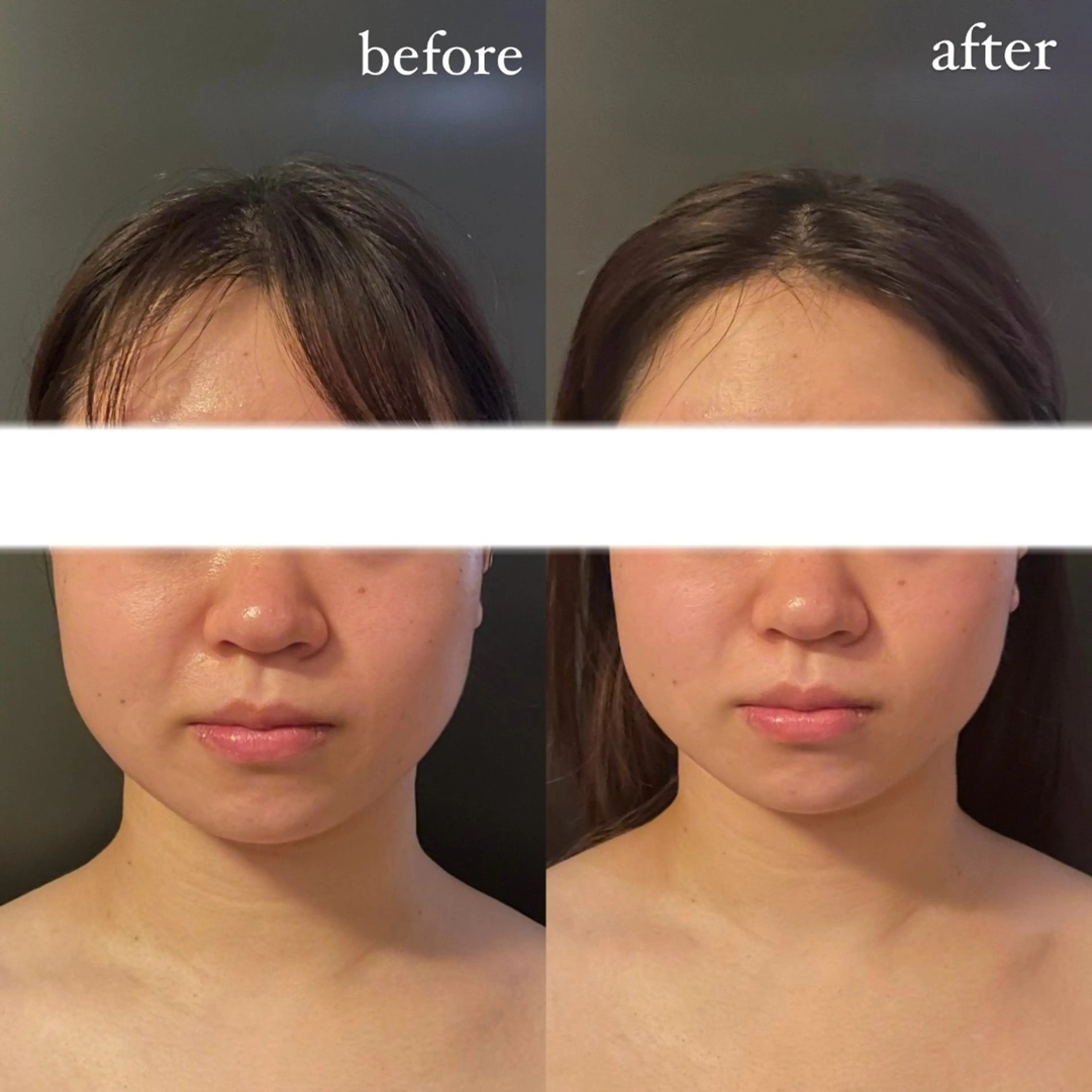 エステ リラク エステサロンino.colore'所属・小顔サロン ino.coloreのエステ・リラクイメージ