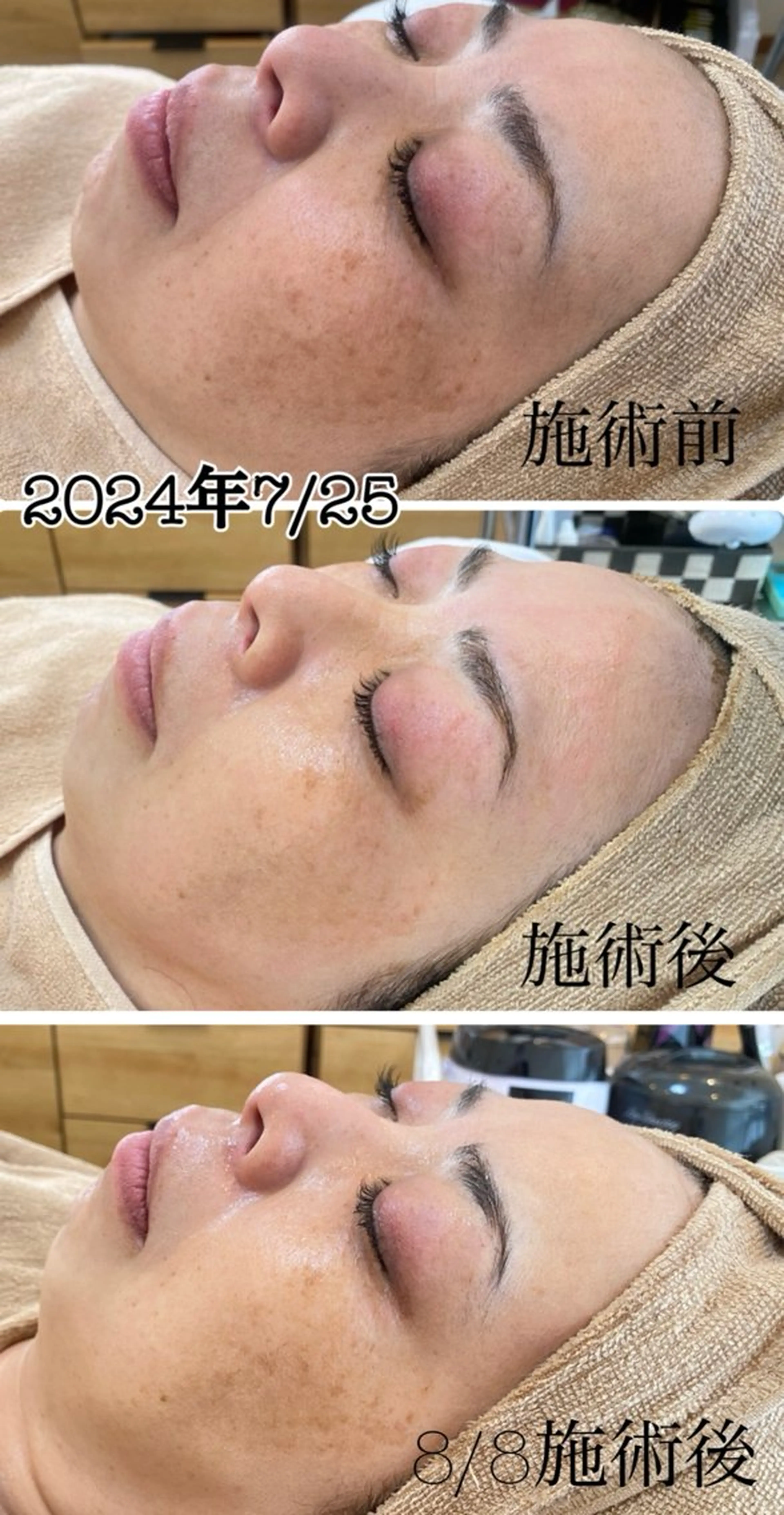 エステ まつげ屋さん こはくのマツエク・マツパデザイン