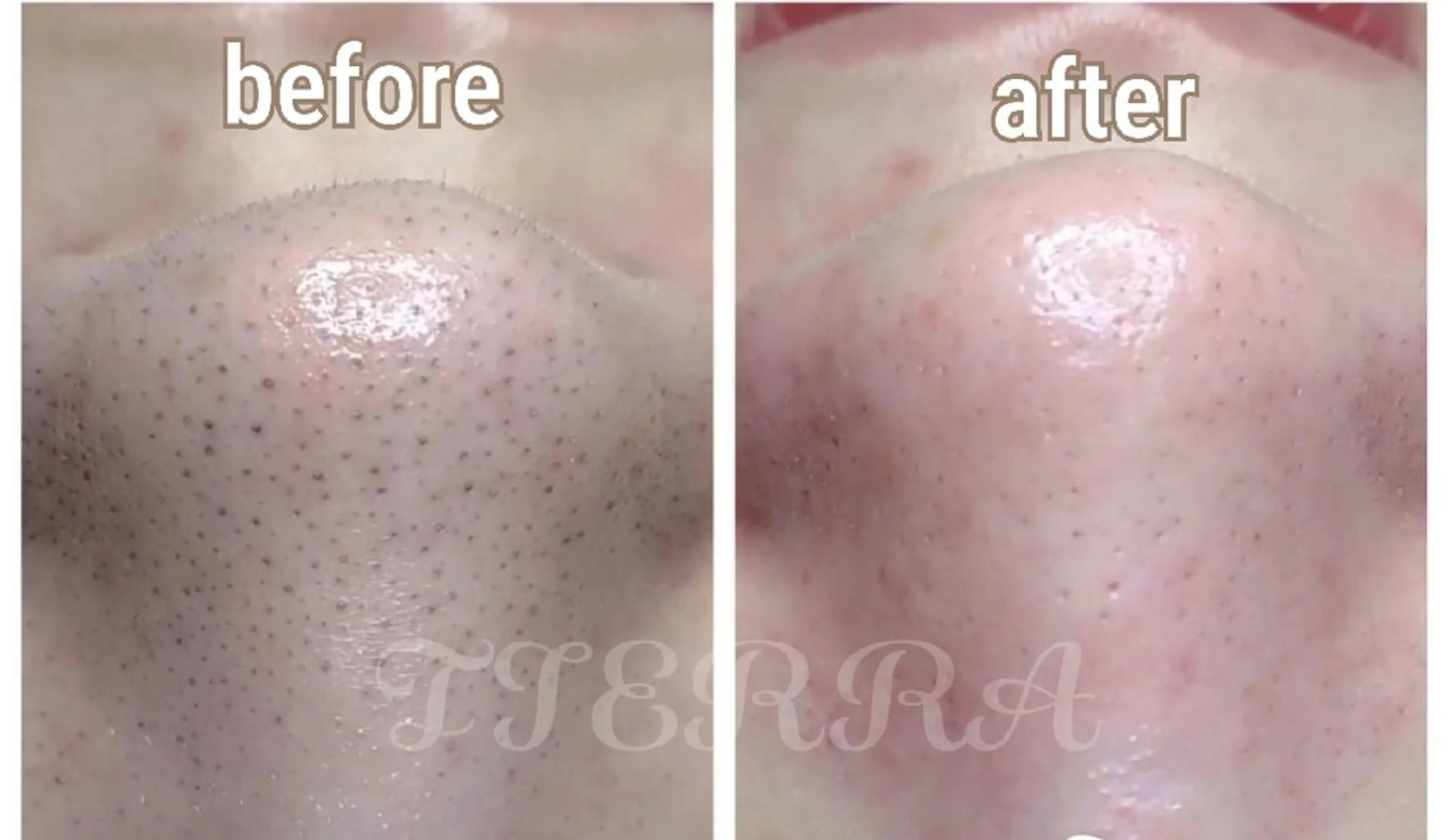 TIERRA(ティエラ)所属・TIERRA ♡のエステ・リラクイメージ