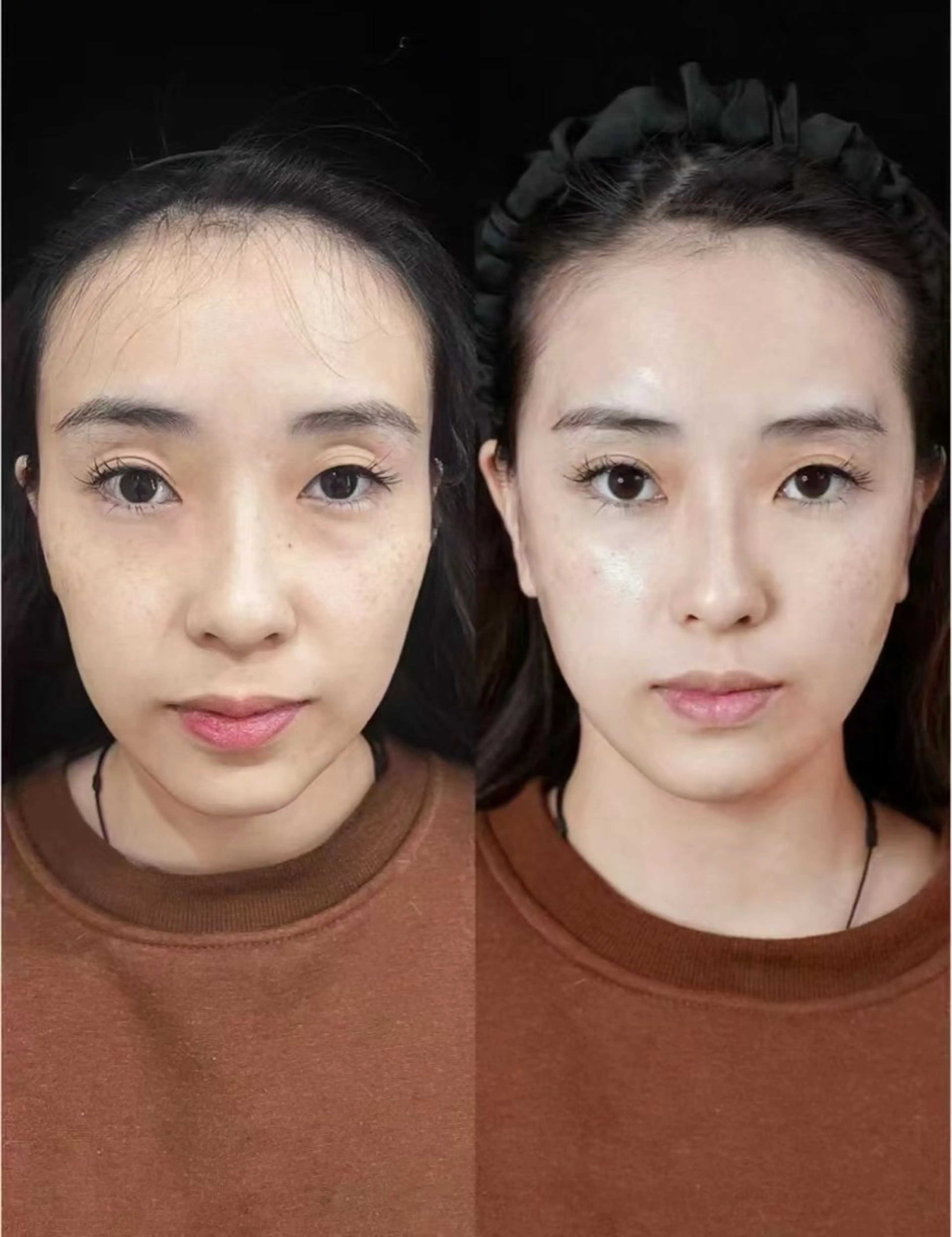 カラー エステ aliaハイフ&水光ジェットサロン所属・aliaハーブ水光店 エステティシャン募集のエステ・リラクイメージ