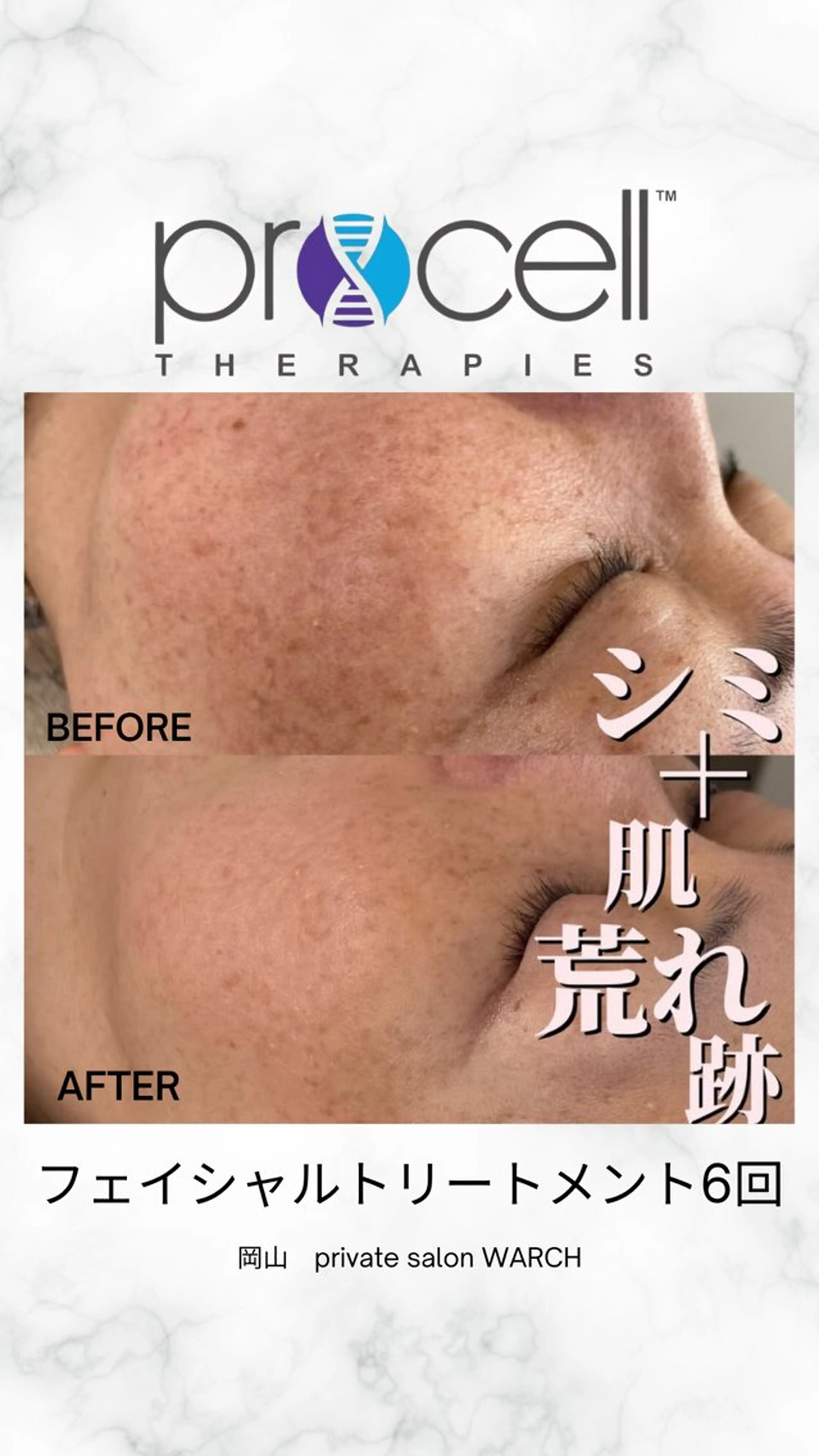 WARCH Marieのその他イメージ