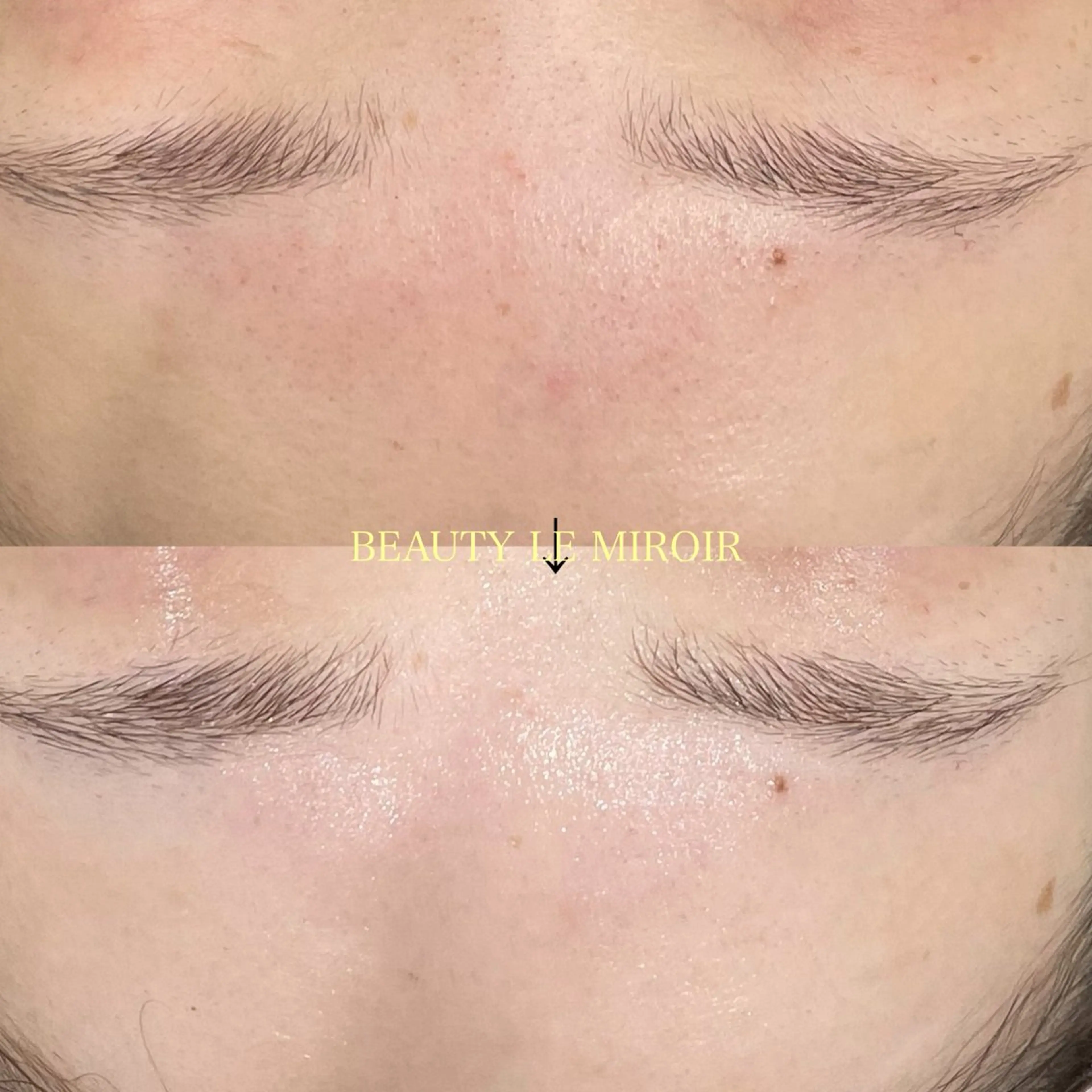 エステ ビューティー ミロワールのエステ・リラクイメージ