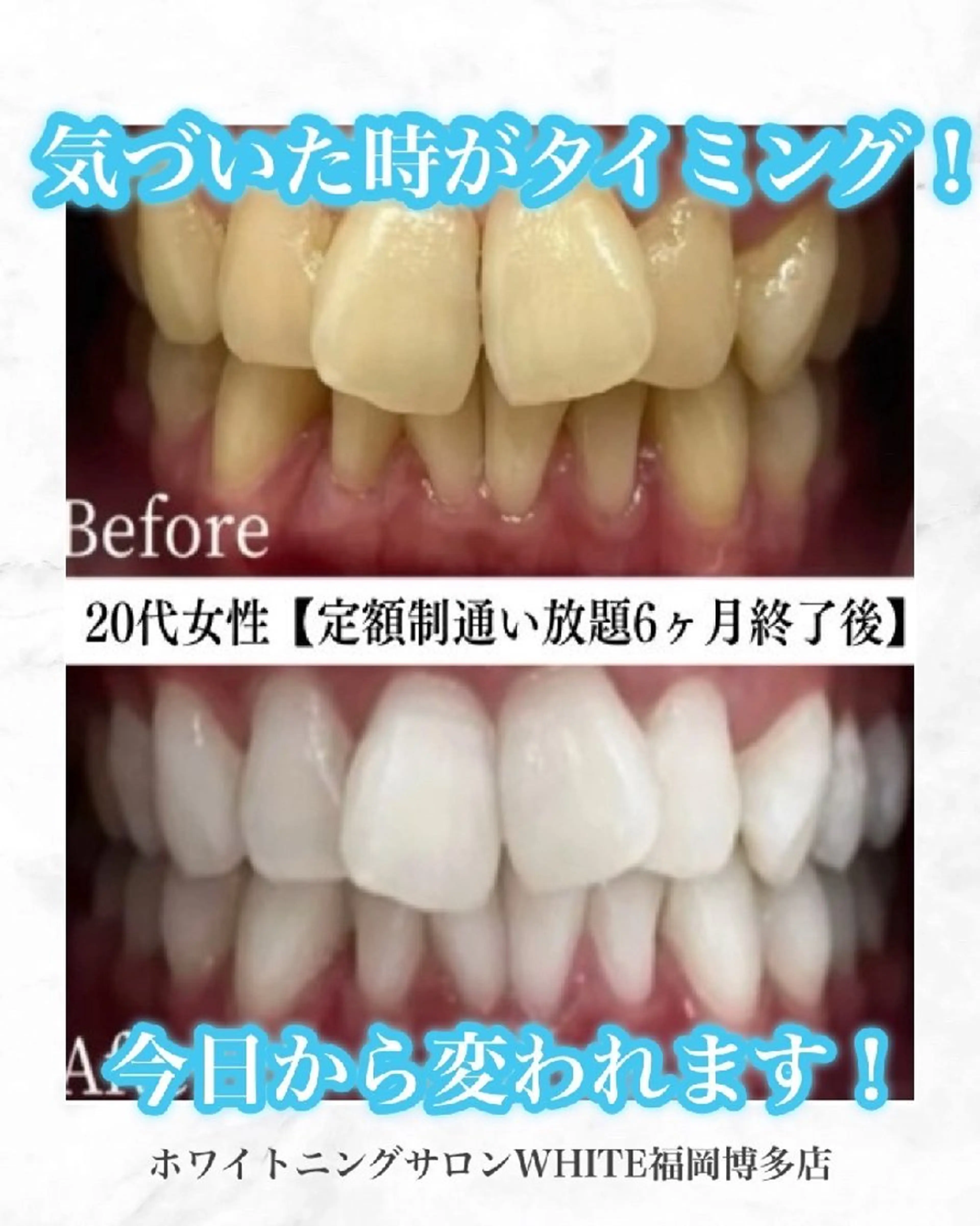 キッズ メンズ エステ リラク ホワイトニングサロン WHITE福岡博多店のエステ・リラクイメージ