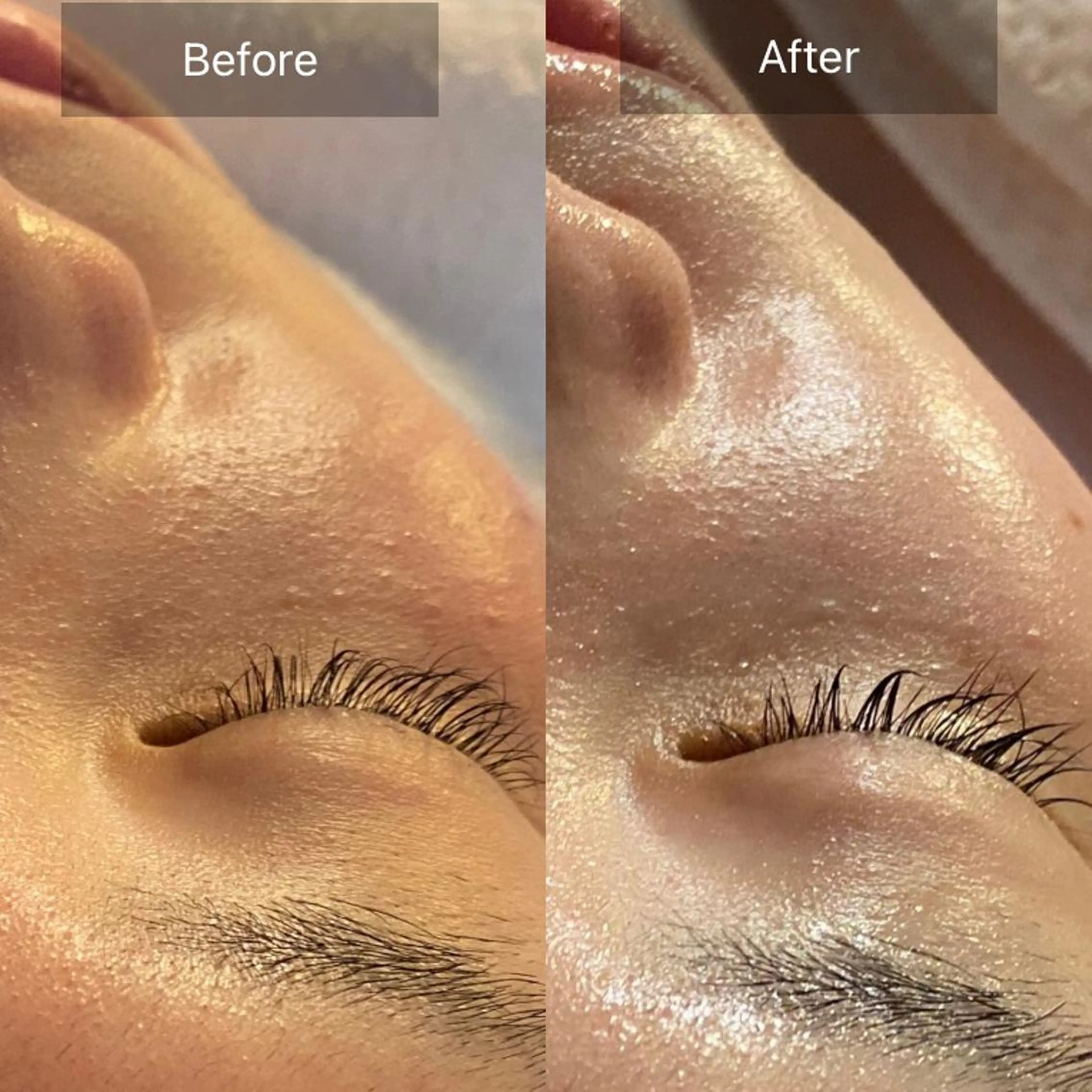 Mandarin Orange所属・毛穴から始める肌メン テマンダリンオレンジのエステ・リラクイメージ