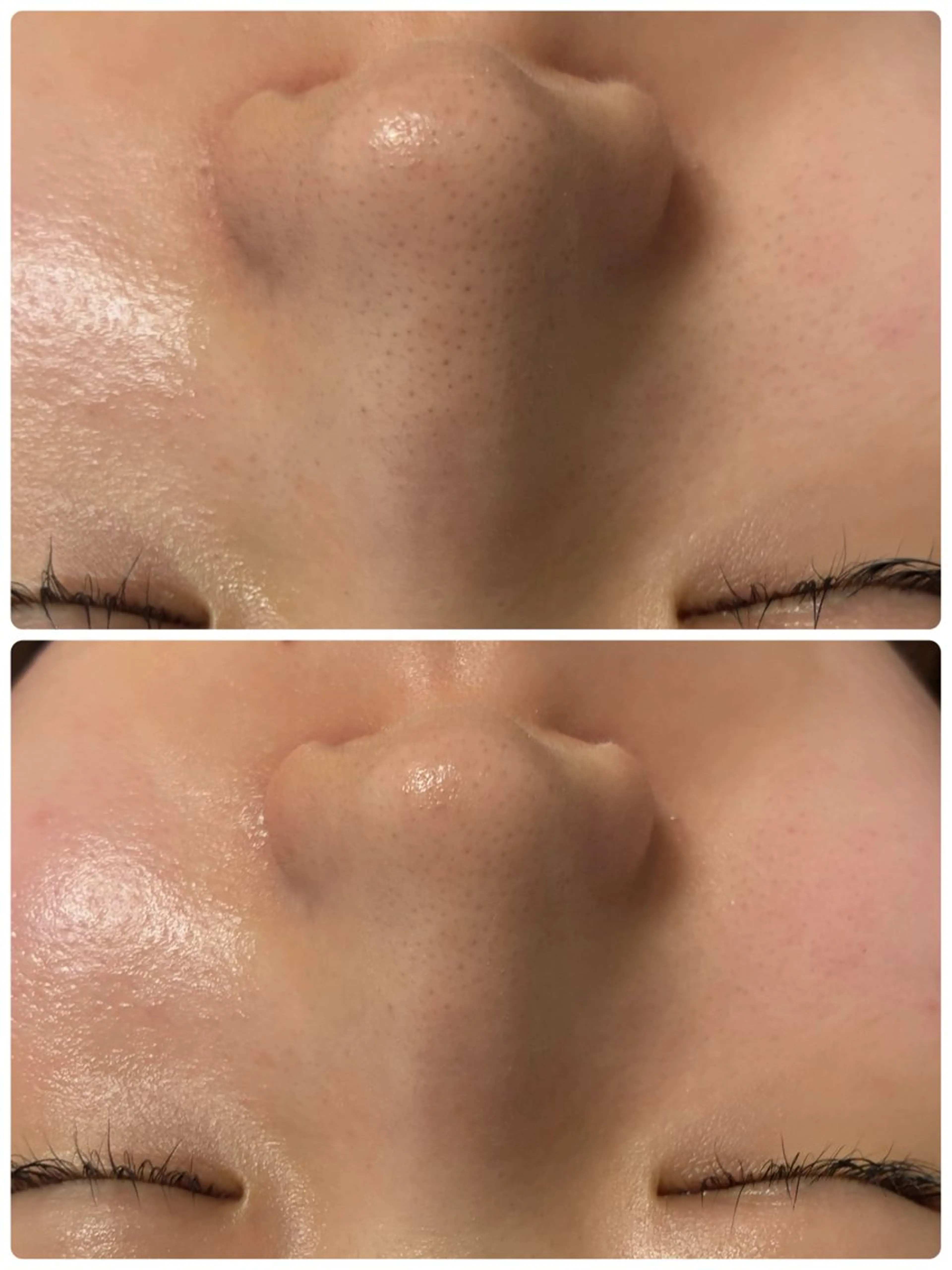 エステ Moena.所属・Moena. 武蔵小杉🫧のエステ・リラクイメージ