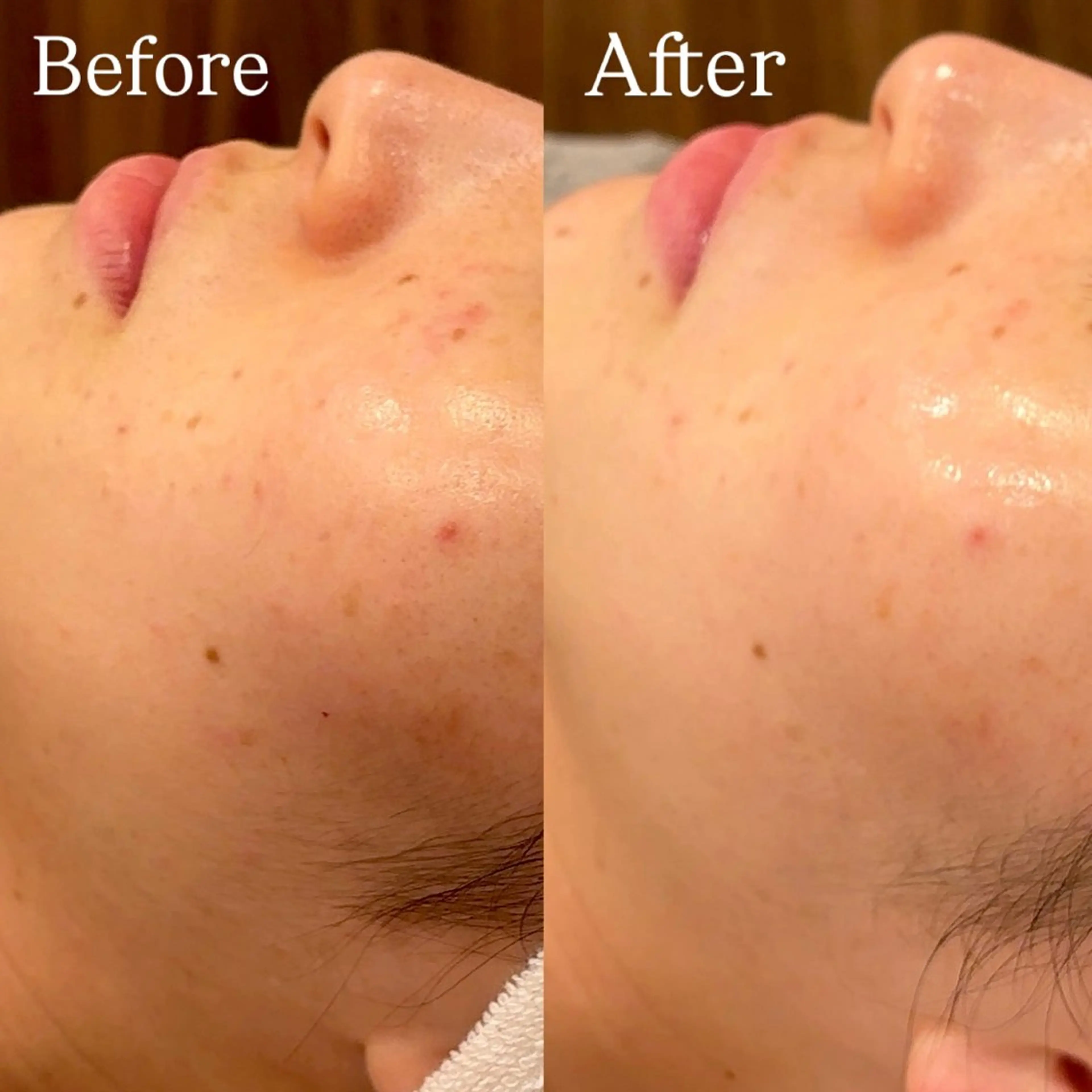 Hari Lounge恵比寿所属・chika🦋 ハリラウンジ恵比寿のエステ・リラクイメージ