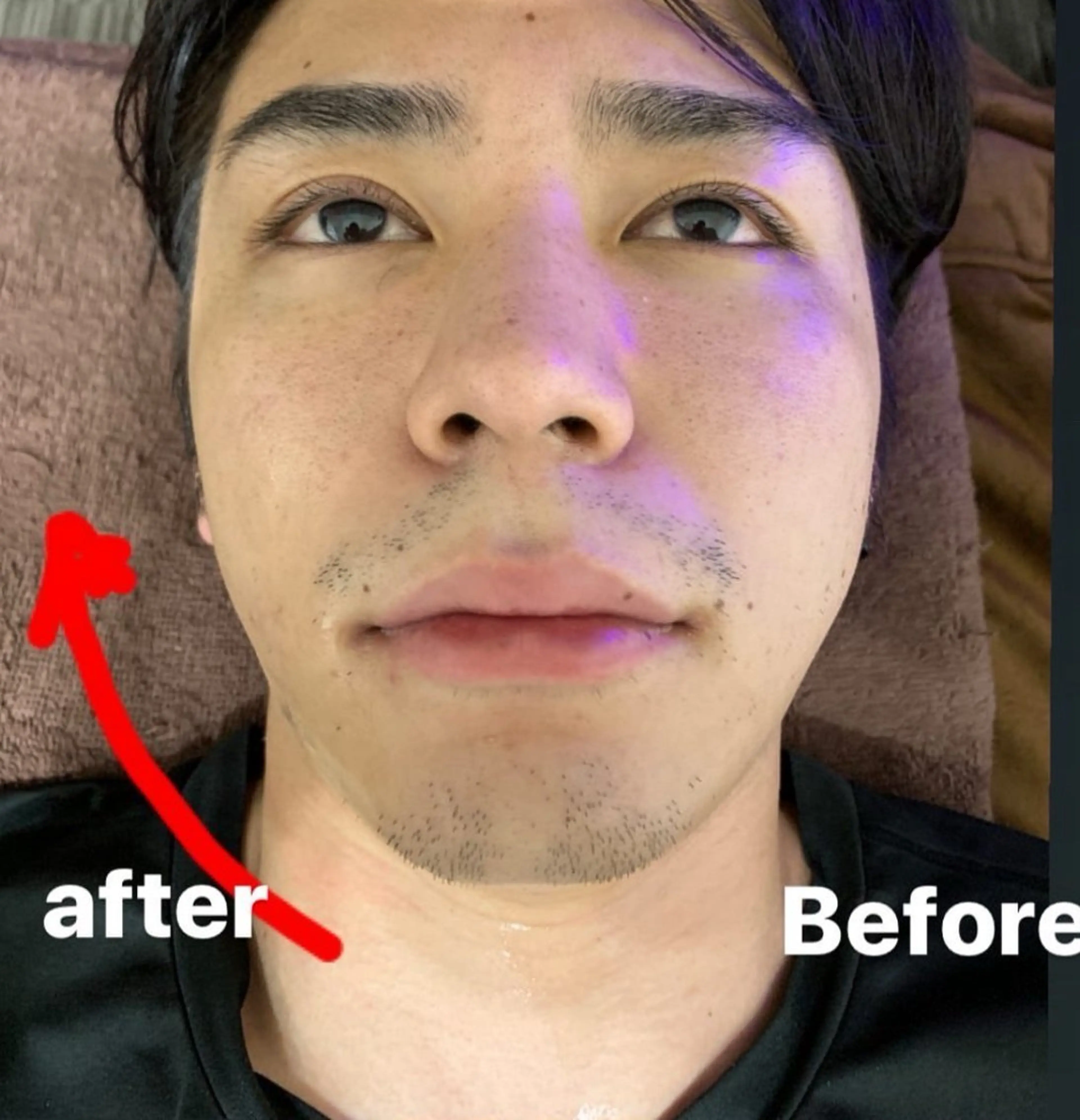 その他 医療提携Ruby池袋店所属・医療提携Ruby小顔 ハーブピーリング加藤のエステ・リラクイメージ