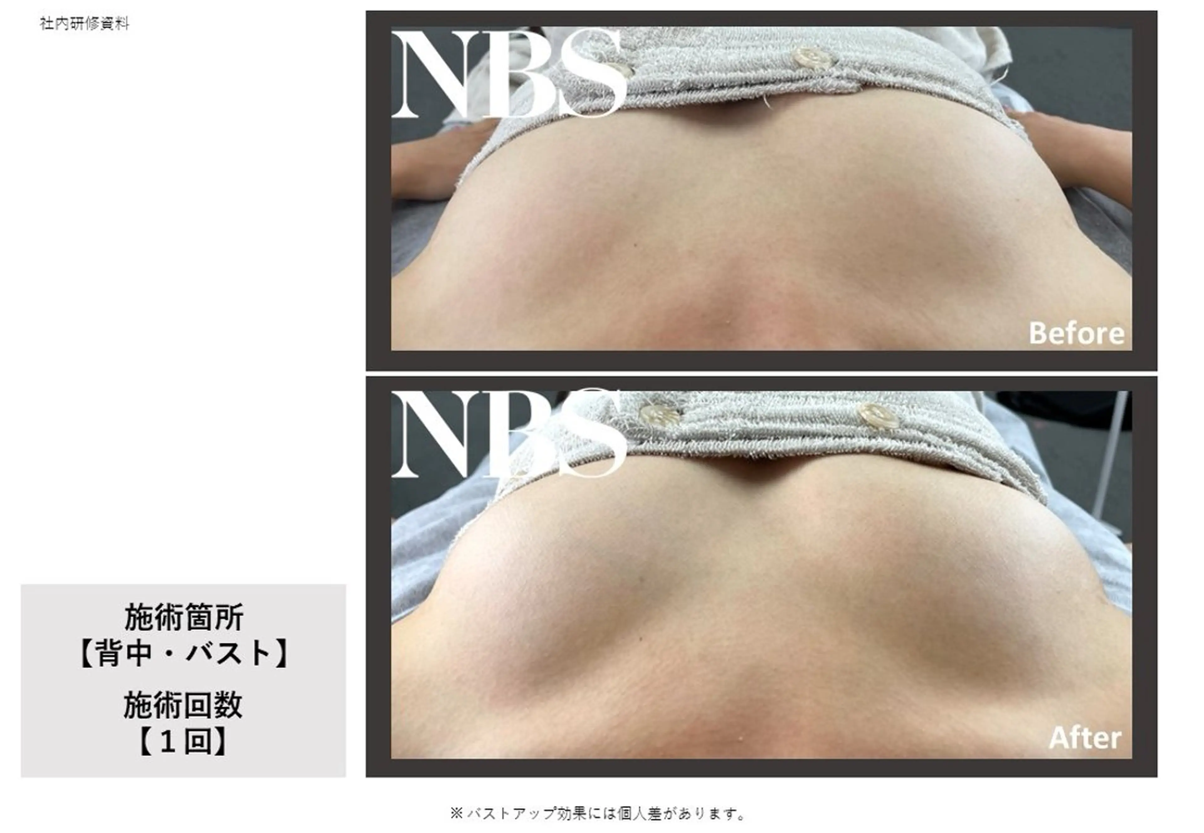 エステ Amaranth所属・Lupinus 小顔矯正のエステ・リラクイメージ