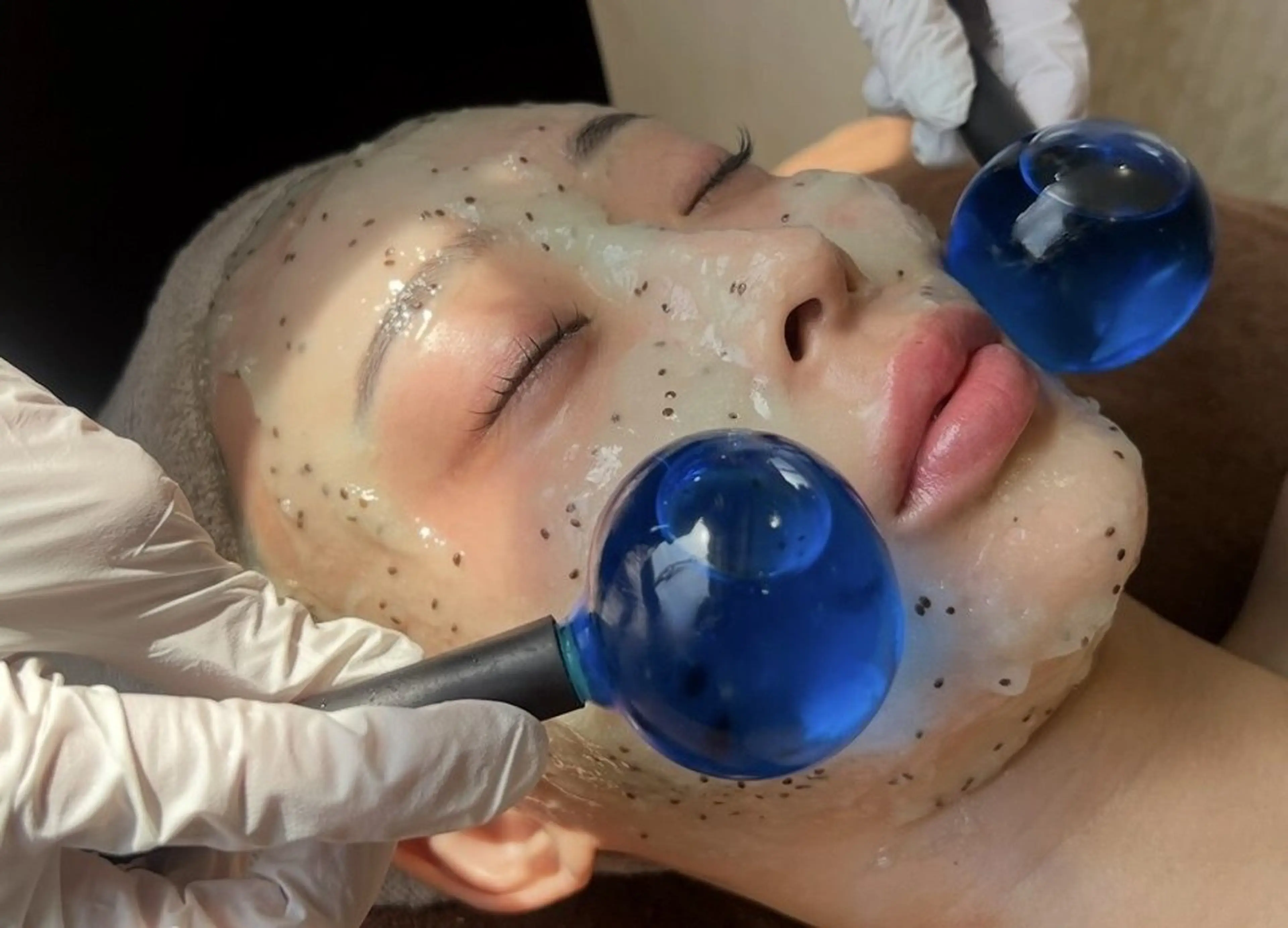 レーザー後や日焼け後/敏感肌にオススメ【3重パック鎮静ケア】 ¥3980🩵の写真