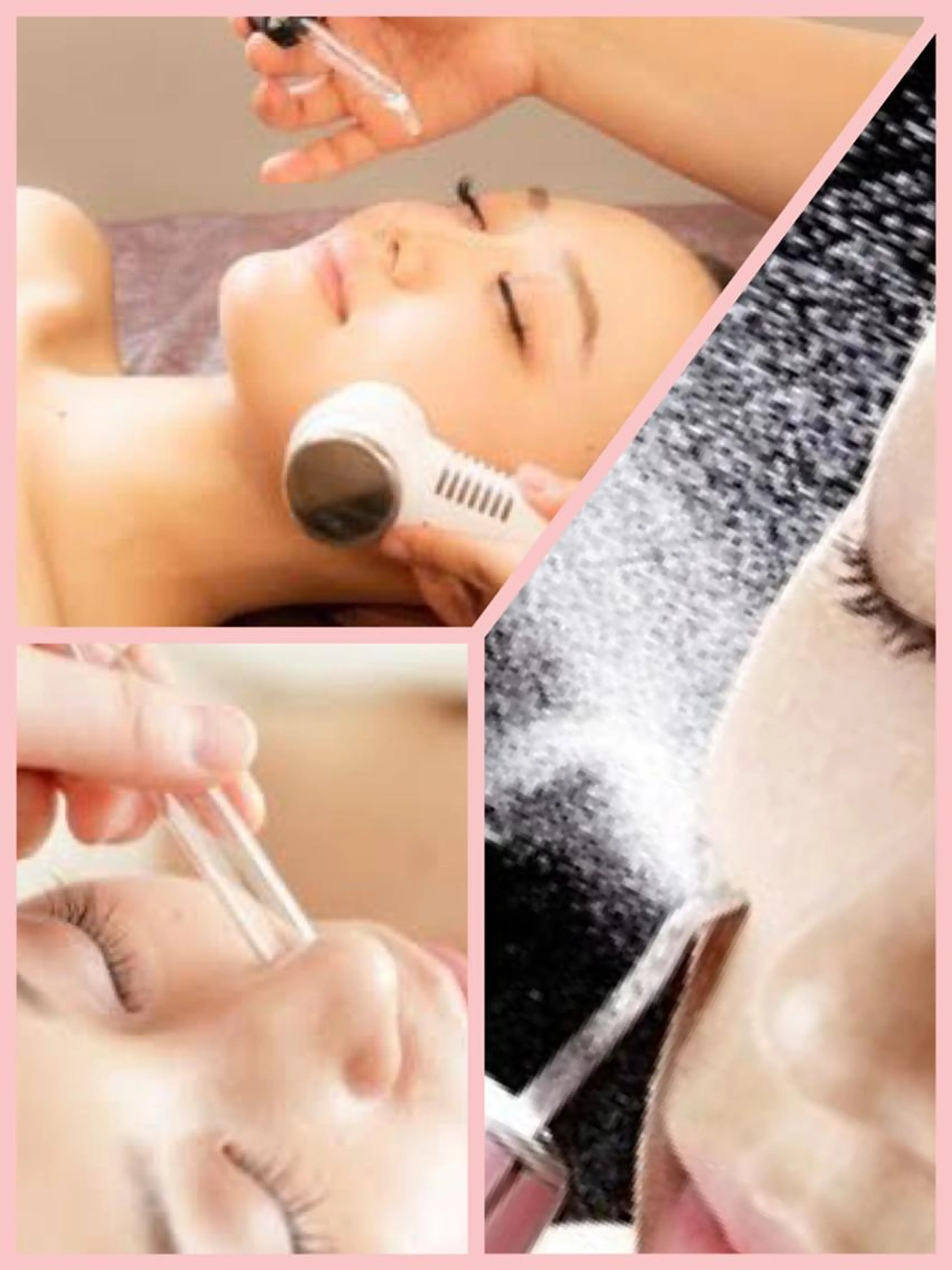 🎅12月限定《毛穴×小顔×美白💆‍♀️Specialケア》6980円→2980円の写真