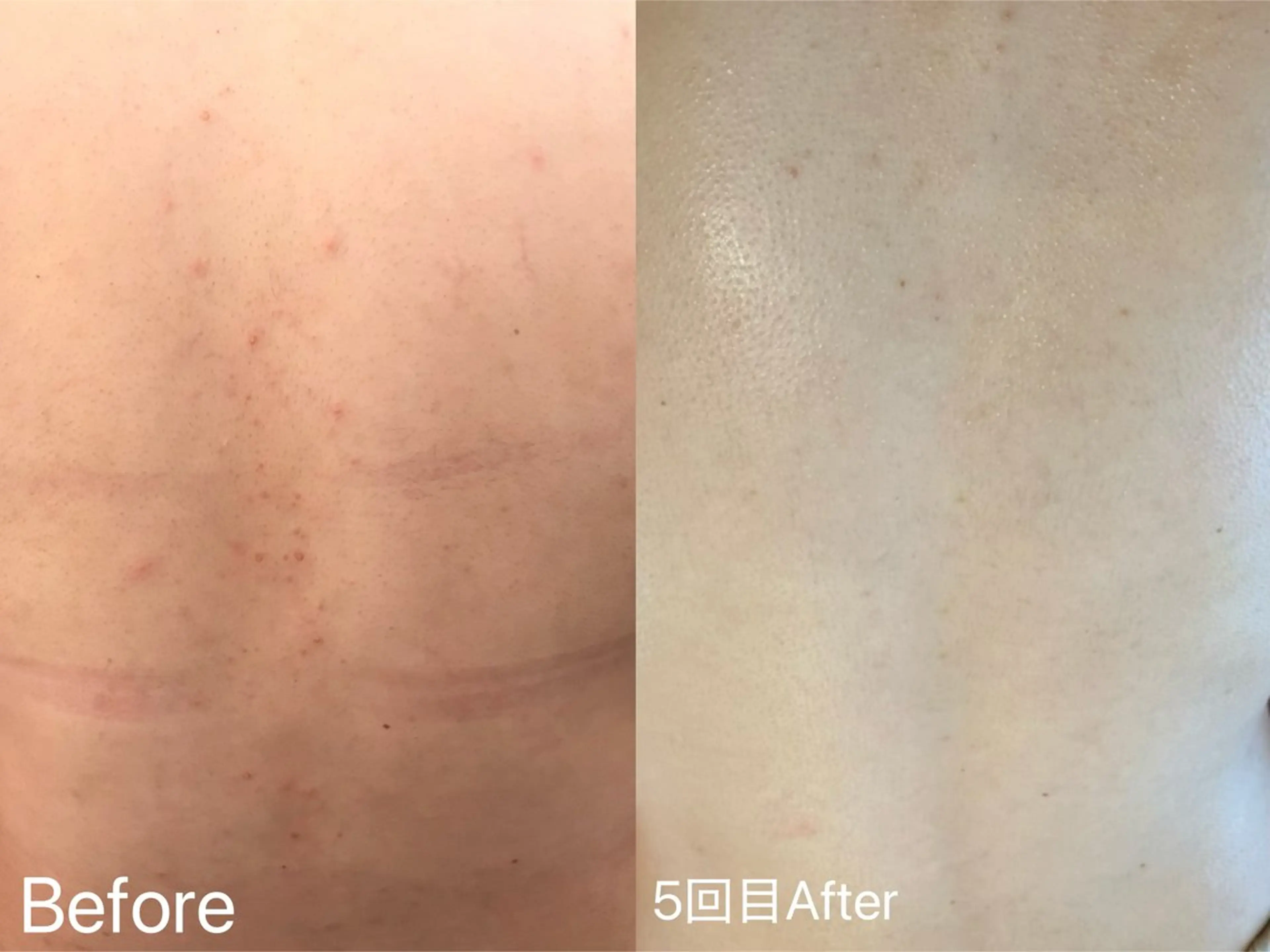 エステ アイラッシュ&エステサロンLinda西宮所属・小顔&毛穴・肌質改善 LINDA西宮 AIのエステ・リラクイメージ