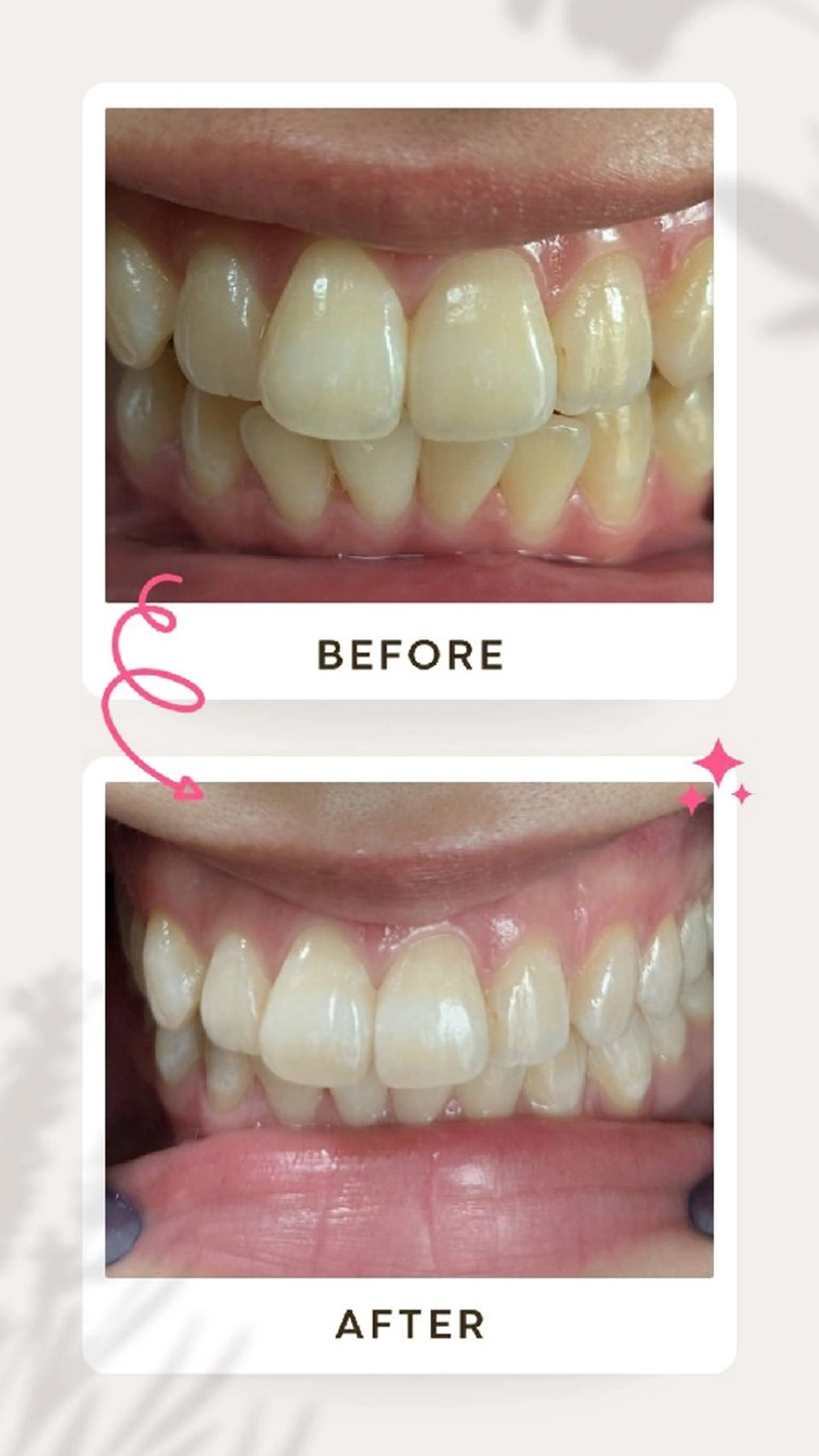 その他 ホワイトニングサロン keiのその他イメージ