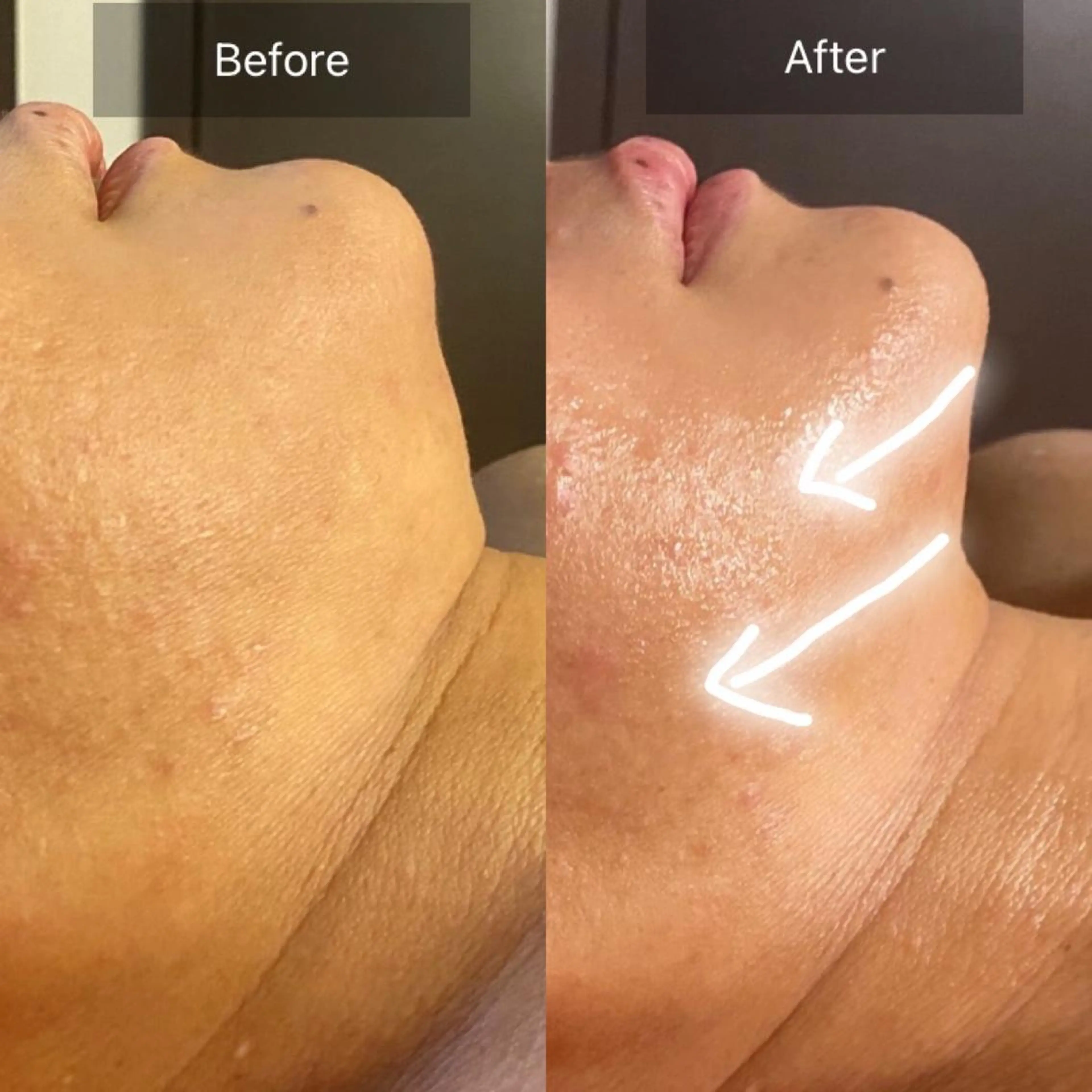 Mandarin Orange所属・毛穴から始める肌メン テマンダリンオレンジのエステ・リラクイメージ