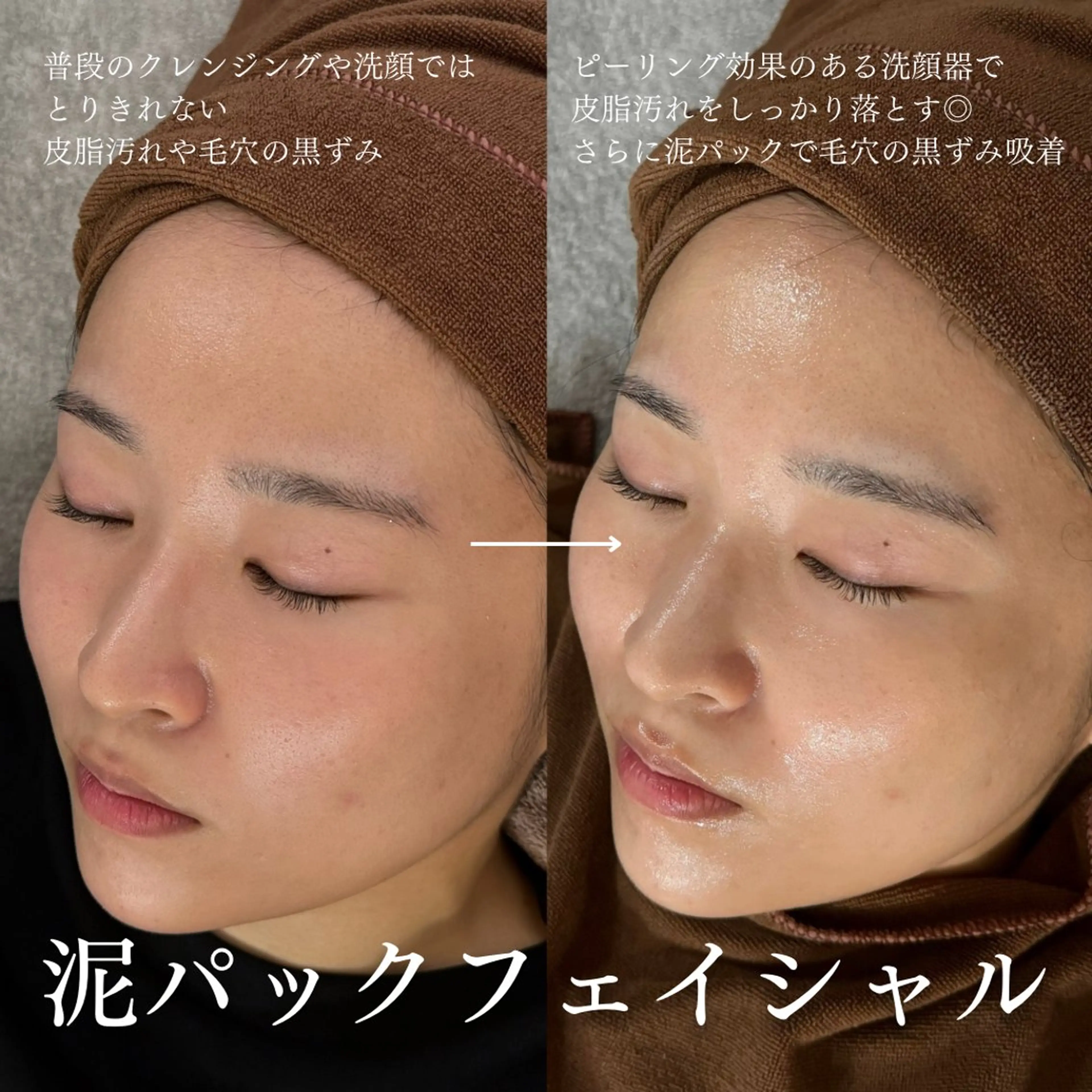 【毛穴ごっそり】深海クレイの泥パック洗浄✨黒ずみ・ザラつきを解消して清潔感UP。の写真