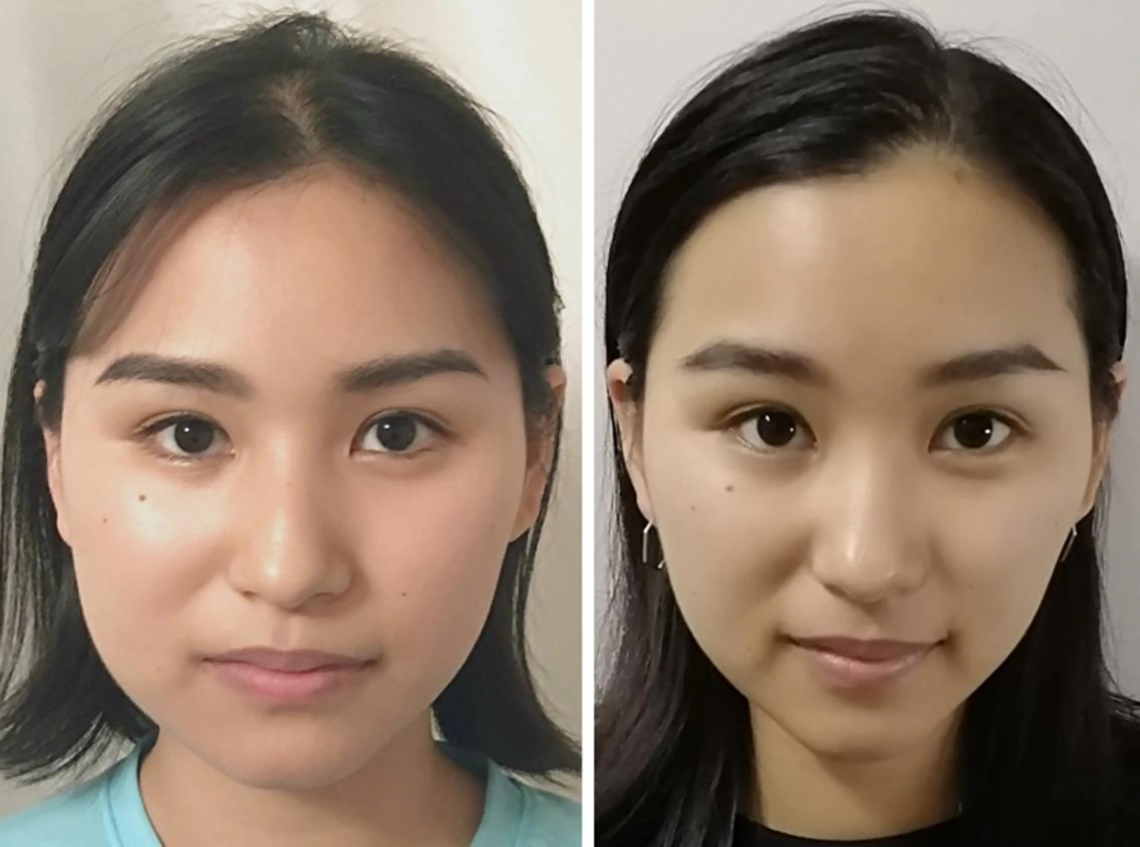 ✨学割U24✨プロの美容整体❗左右差/猫背/巻き肩/肩幅🙆‍♂️全身整う😁【小顔矯正＋骨盤矯正＋頭蓋骨矯正】 90分の写真