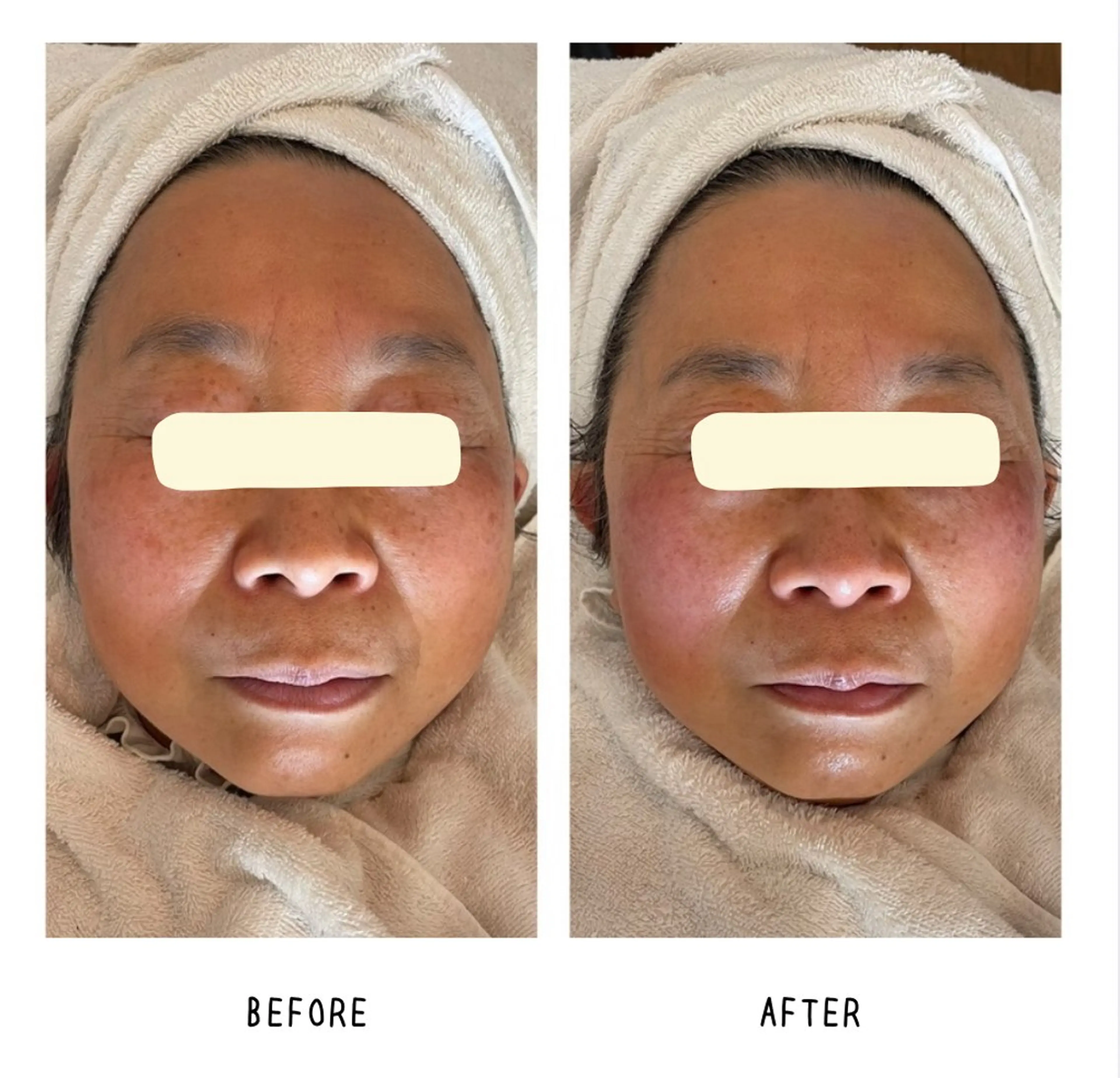 grow所属・Yoshino Erinaのエステ・リラクイメージ