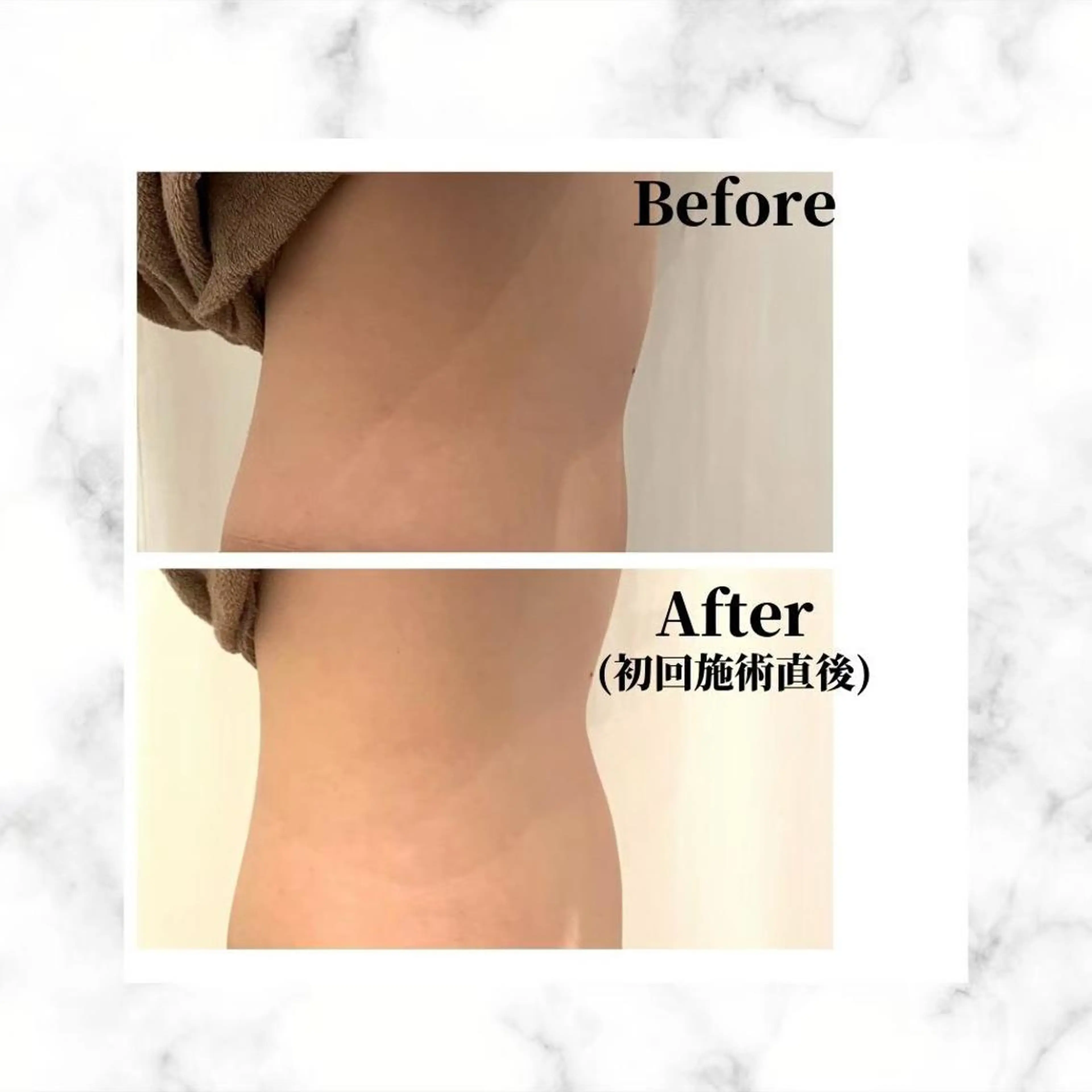 エステ リラク 12Dハイフ💗 最強小顔のエステ・リラクイメージ